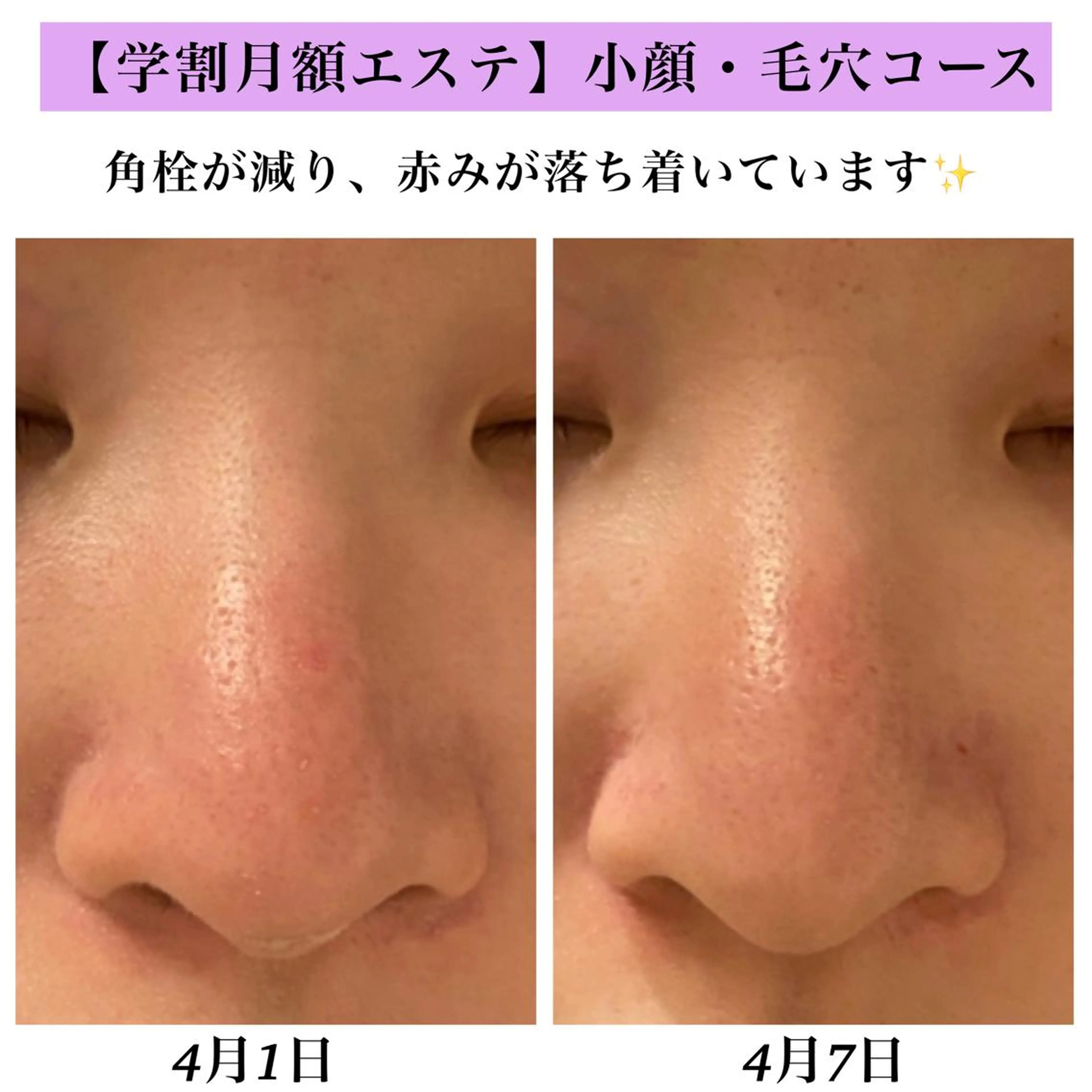 Bellesthe (ベルエステ)のエステ・リラクイメージ