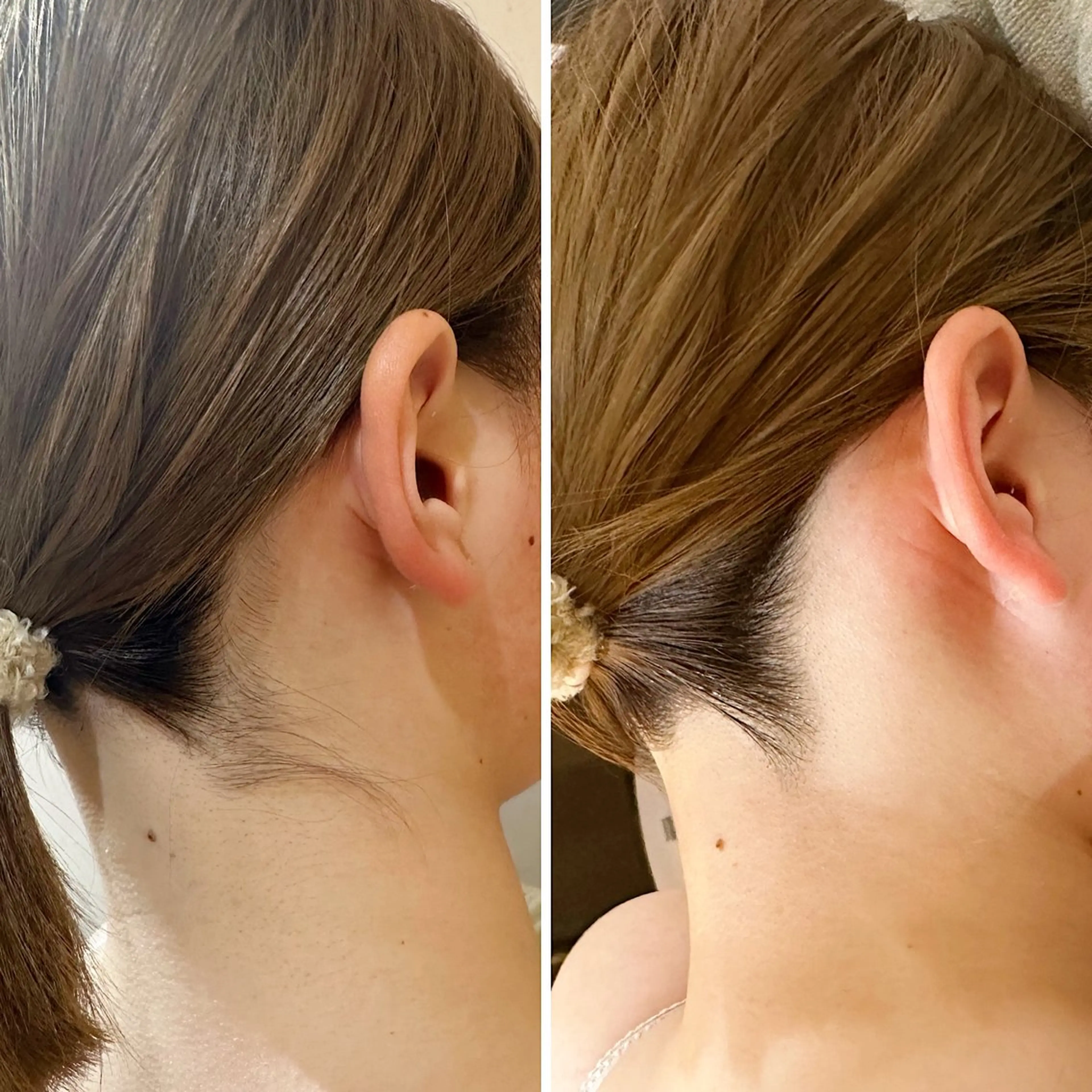 脱毛 うなじ脱毛/美肌脱毛 LABELのエステ・リラクイメージ