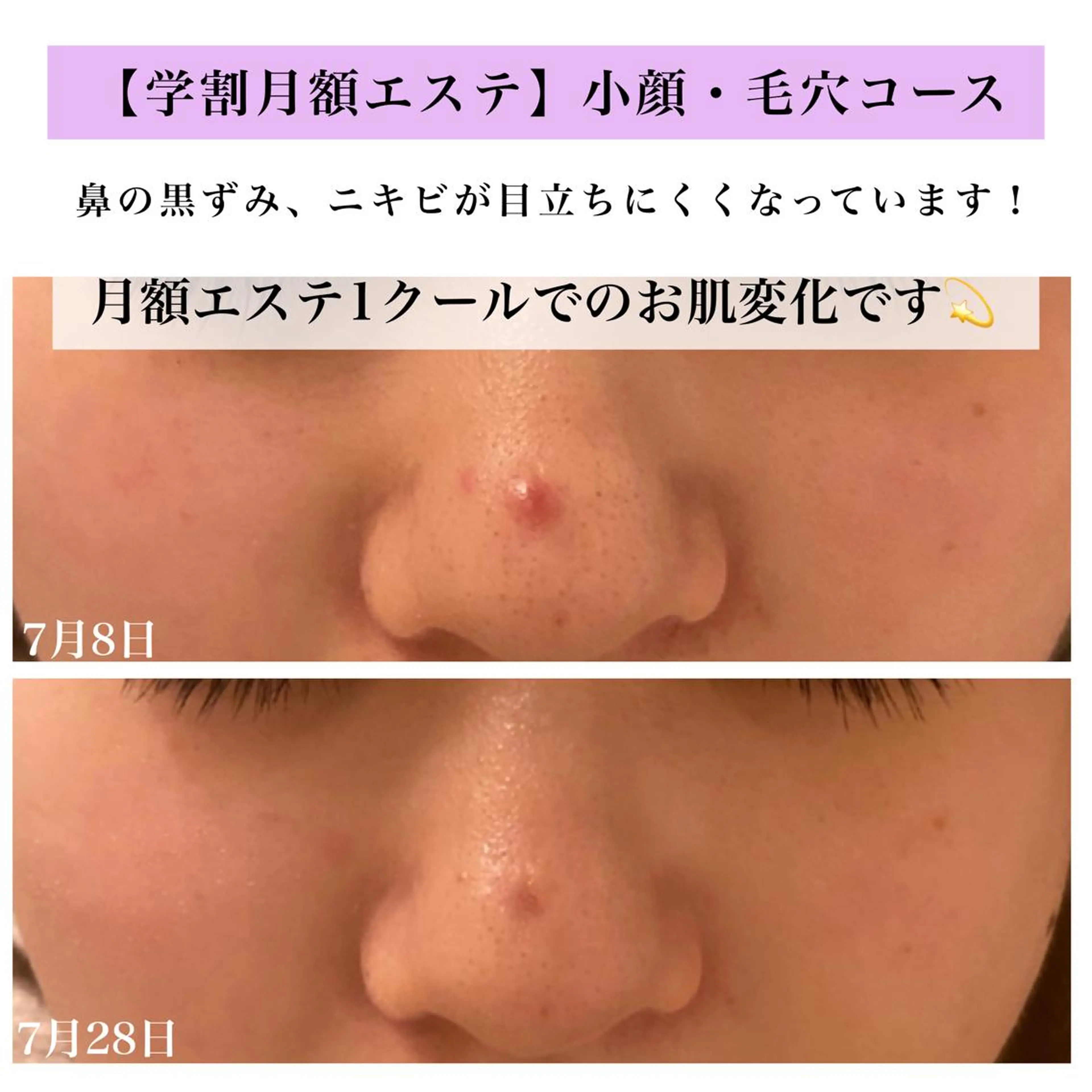 Bellesthe (ベルエステ)のエステ・リラクイメージ