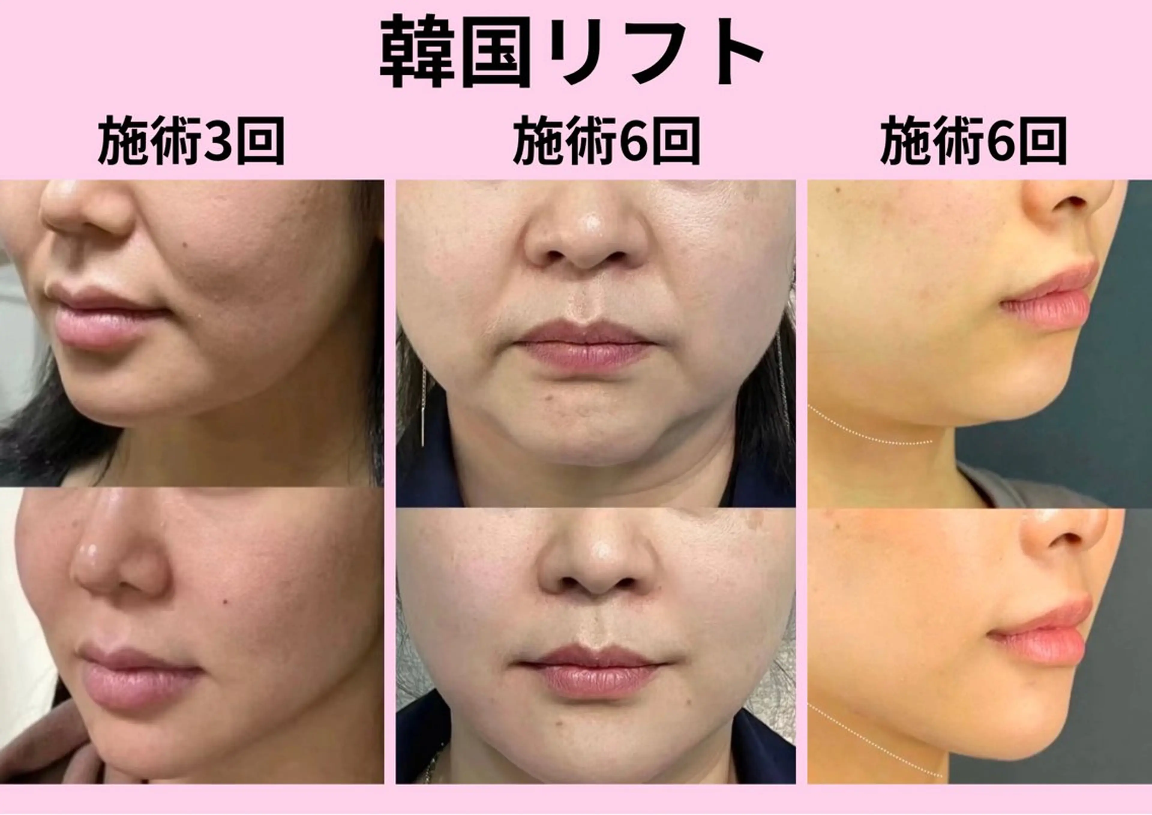 マツエク・マツパ エステ リラク 愛維美水光美肌専門店 メンズレディースokのエステ・リラクイメージ