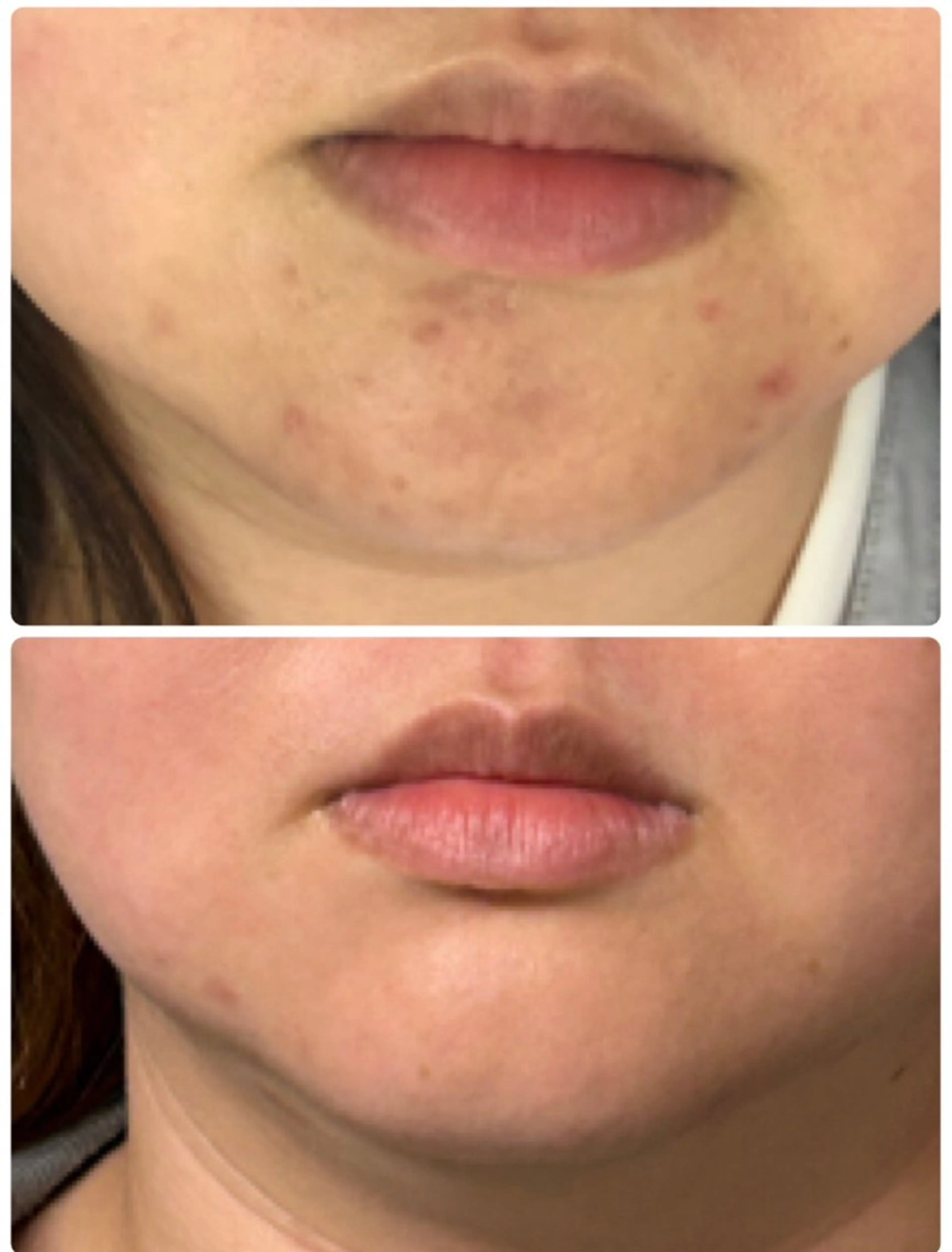 エイジング肌質改善 サロンプレジールのエステ・リラクイメージ