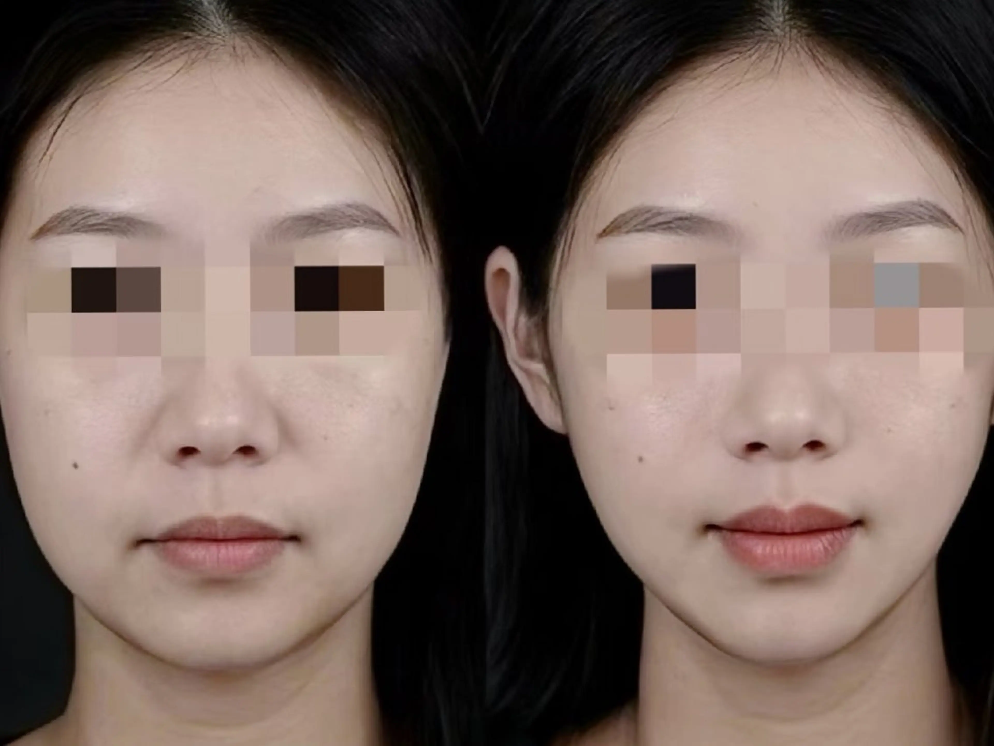 エステ aliaハイフ&水光ジェットサロン所属・aliaハーブ水光店 エステティシャン募集のエステ・リラクイメージ