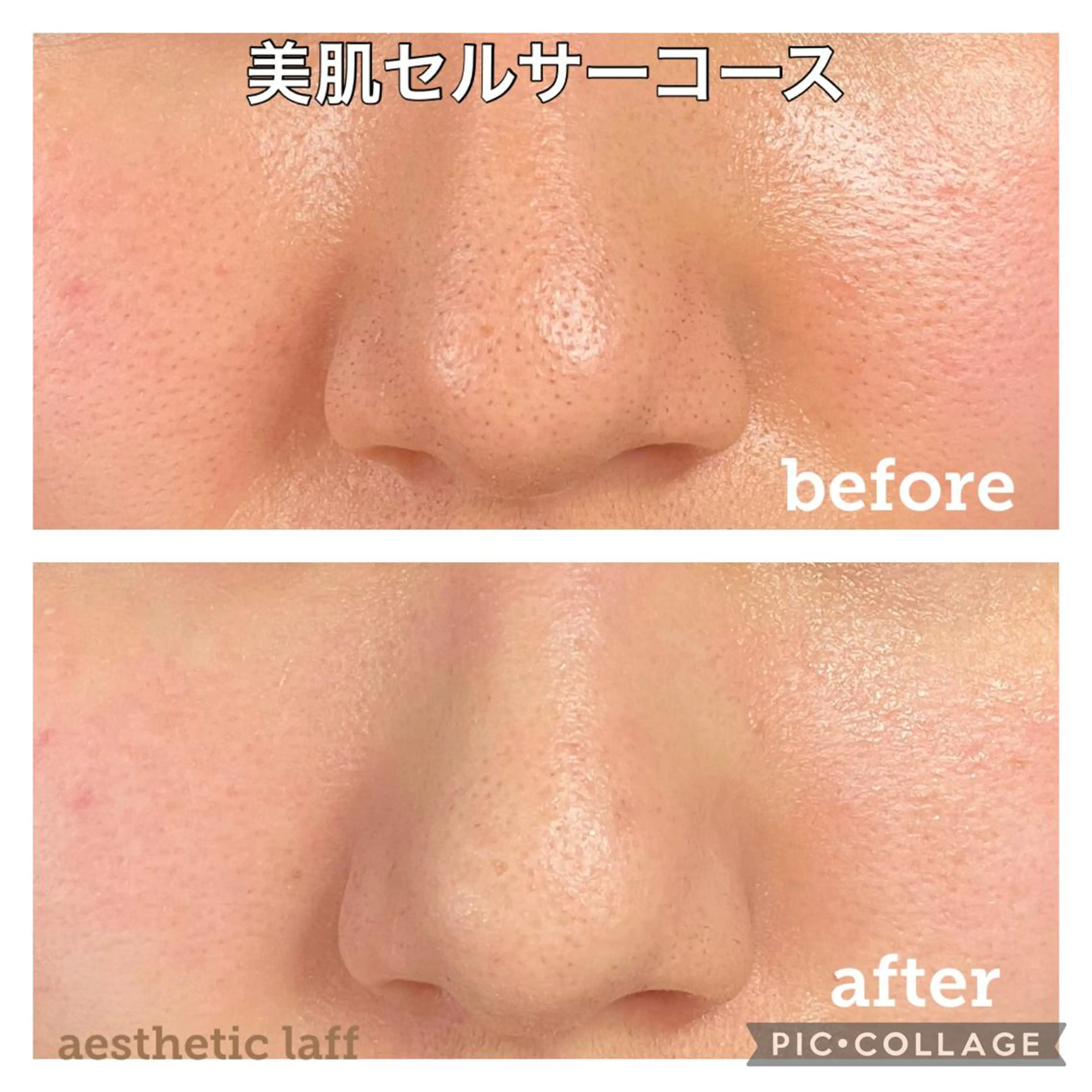 美肌作りのサロン 山村亜美のエステ・リラクイメージ