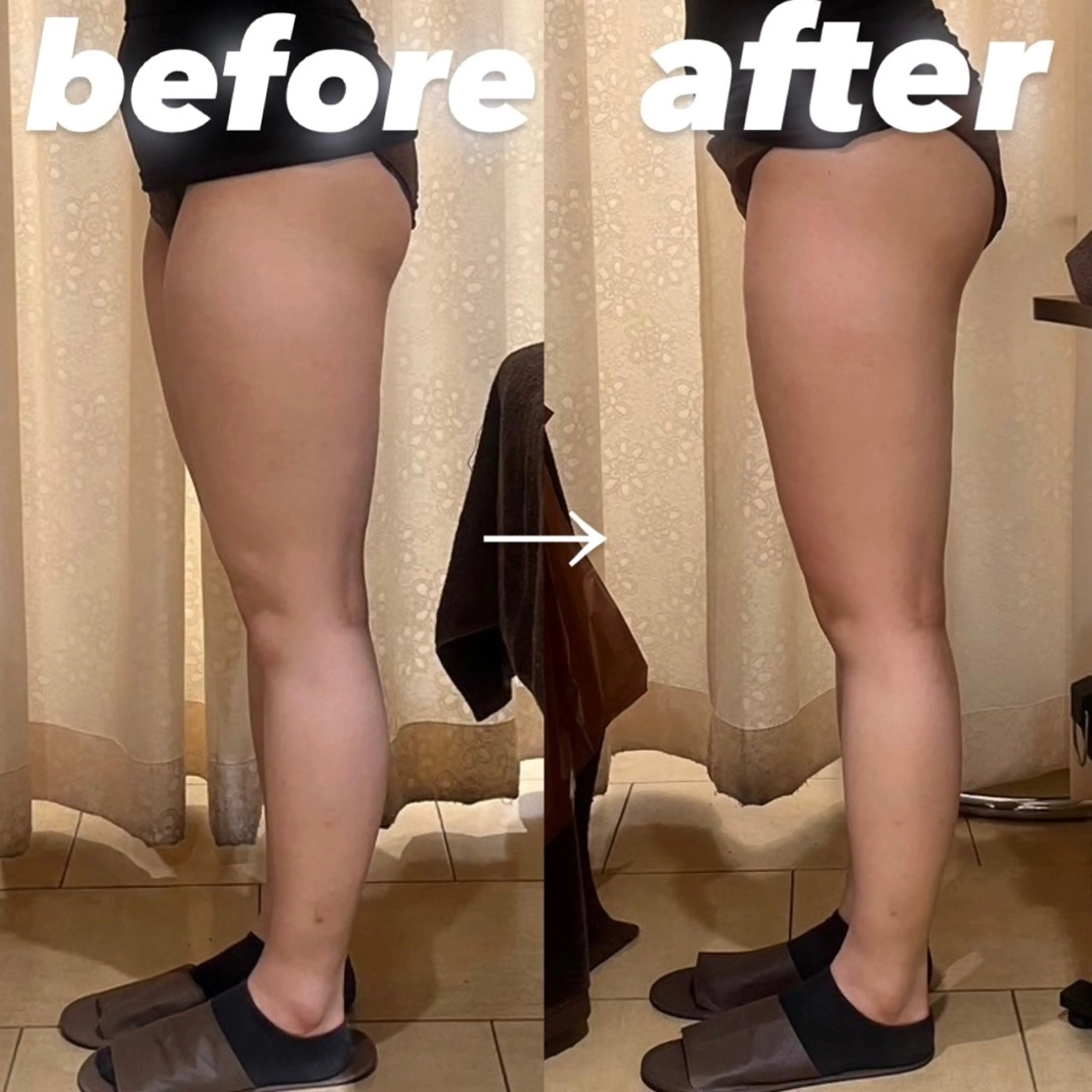 BeauL銀座 村浜友菜🤍のエステ・リラクイメージ