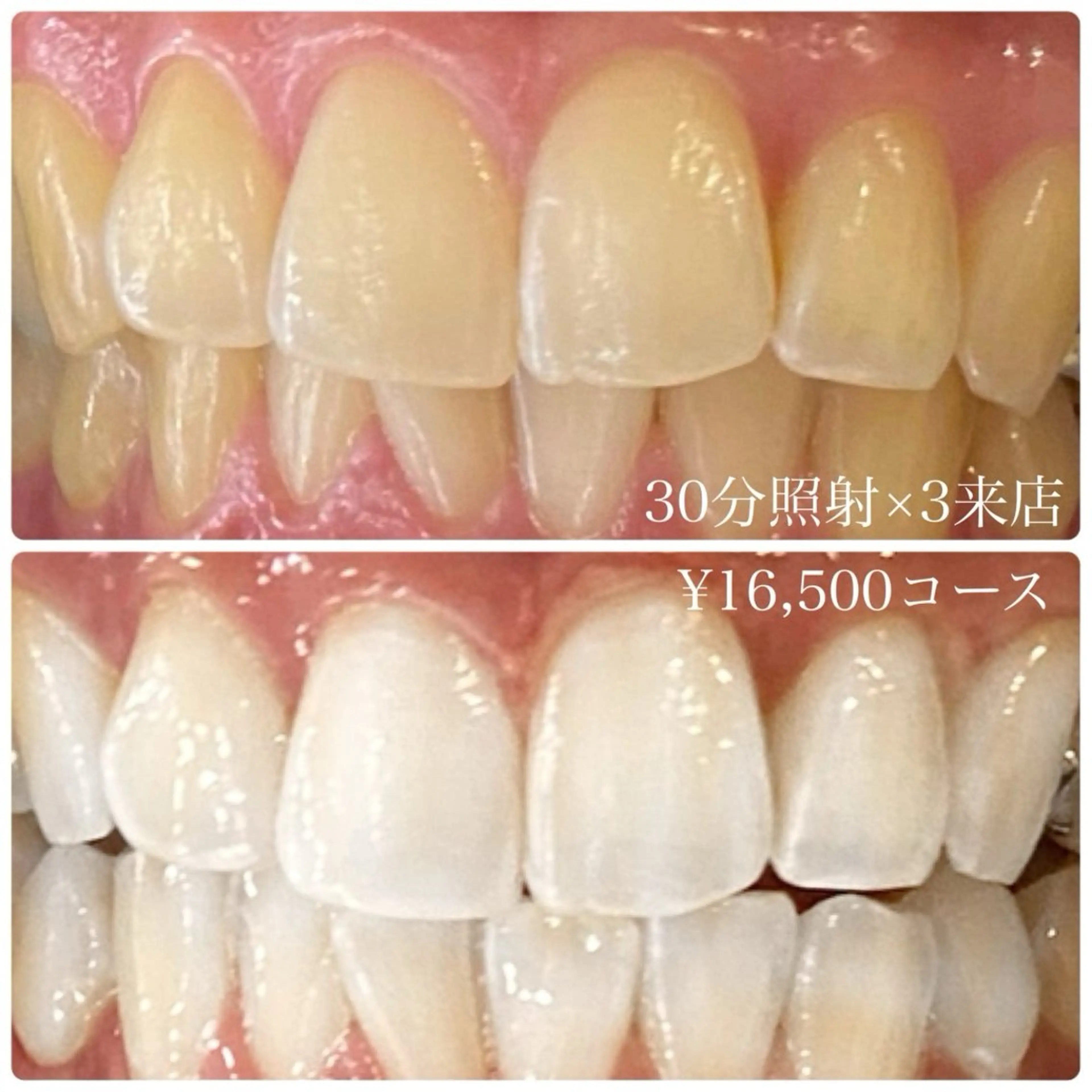 ホワイトニングルーム 横浜店のその他イメージ