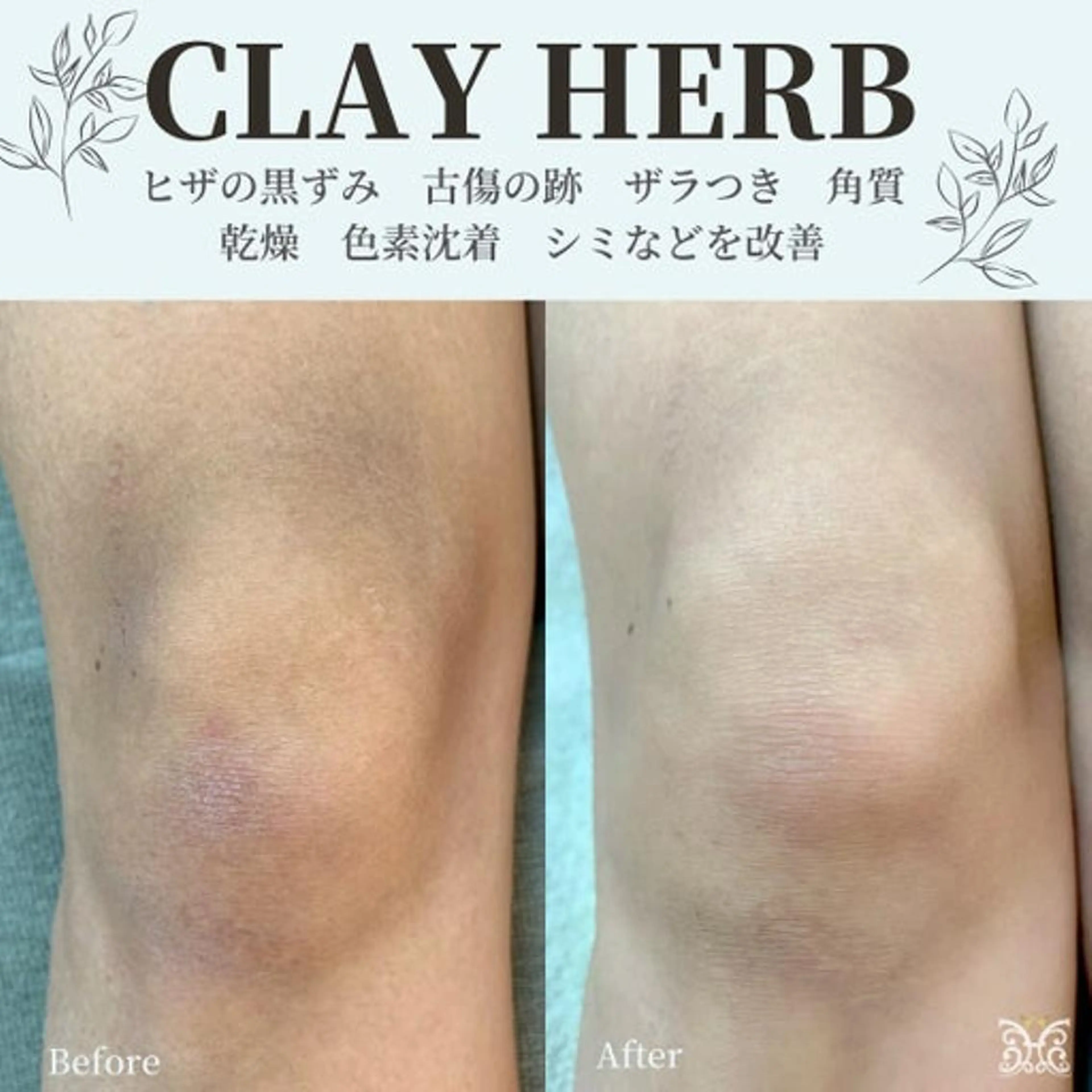 美肌&アロマ🌸 nana 中目黒のエステ・リラクイメージ