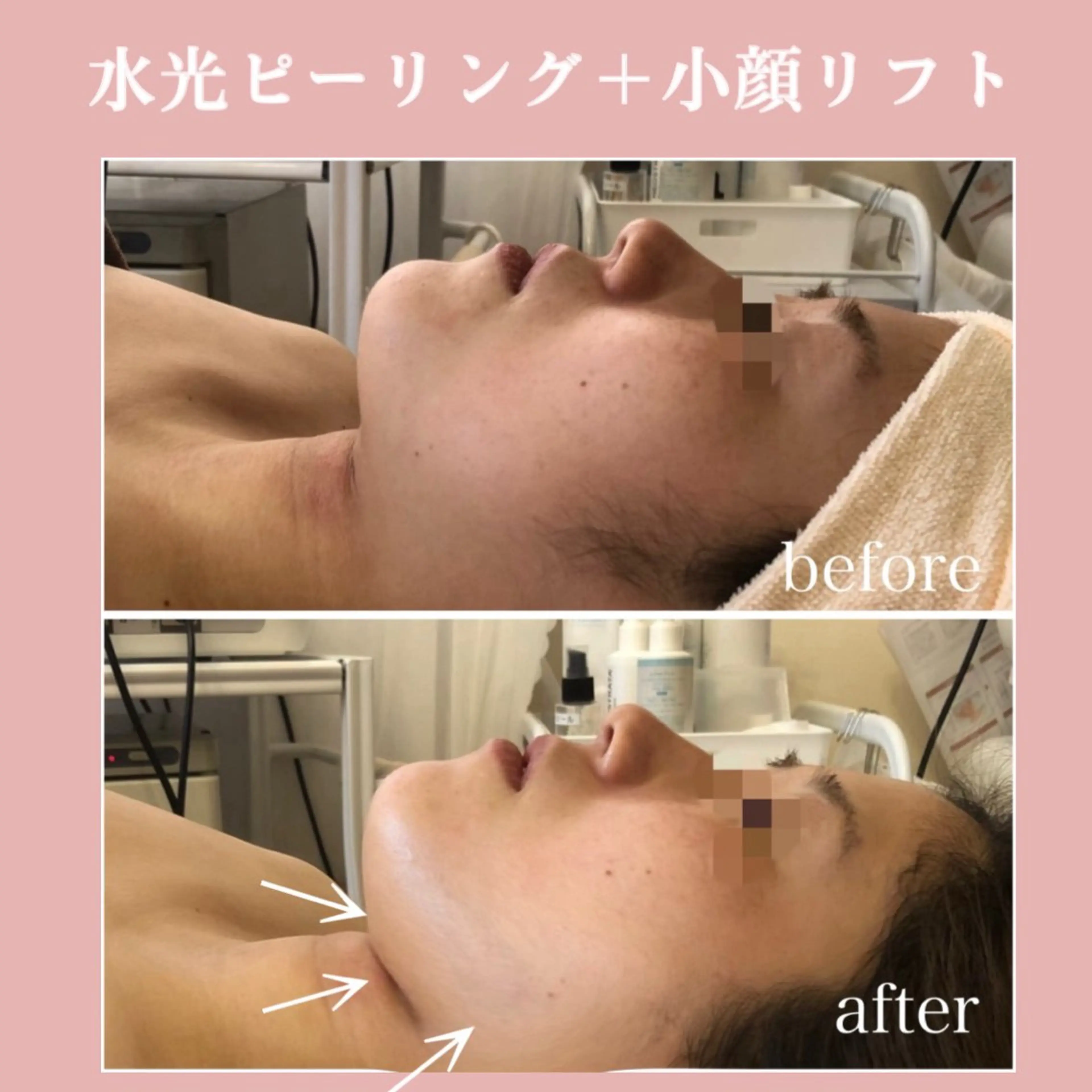 ROCO yuiの眉毛・アイブロウイメージ