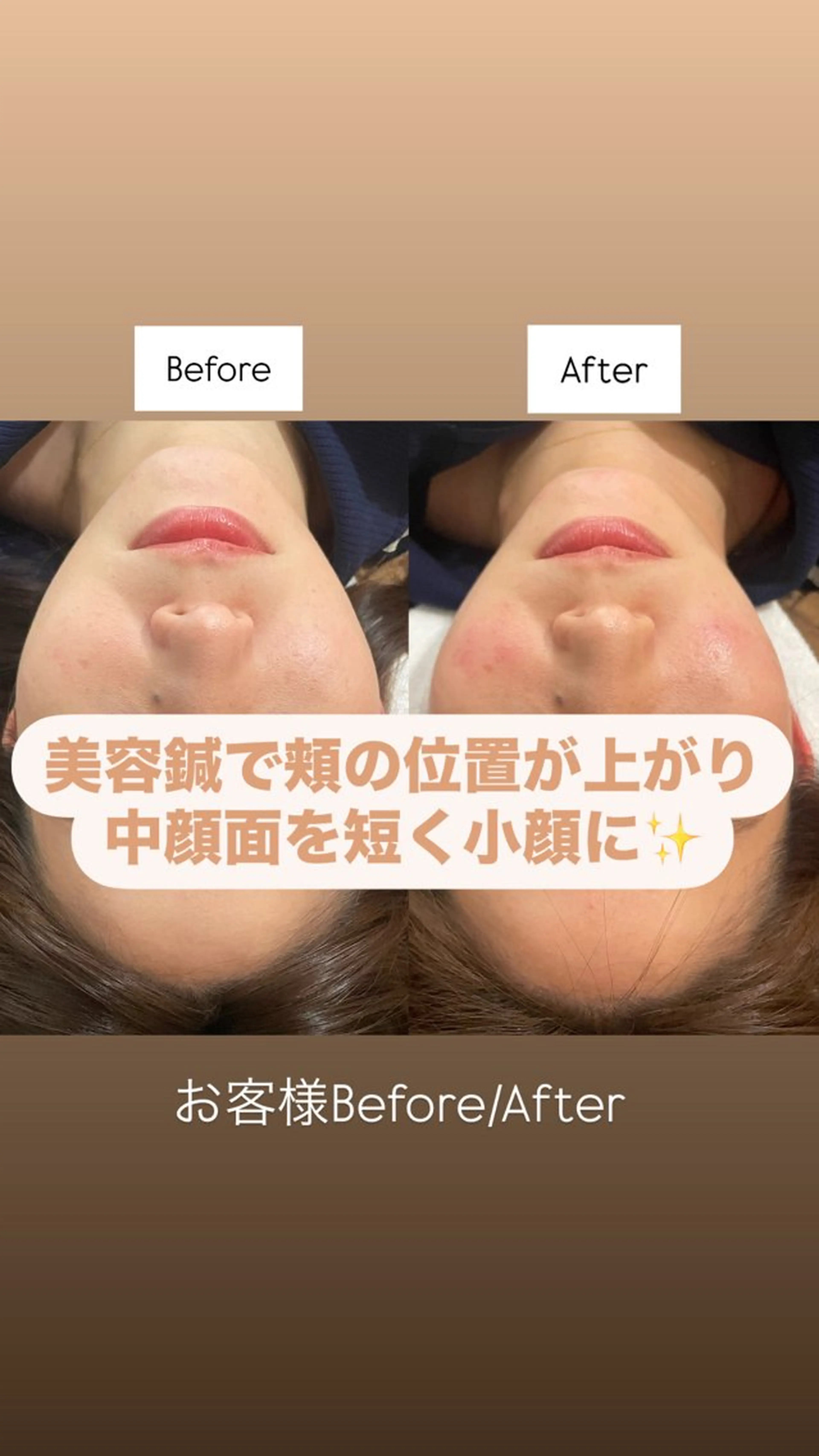 美容鍼/鍼灸 ここみ鍼灸院のエステ・リラクイメージ