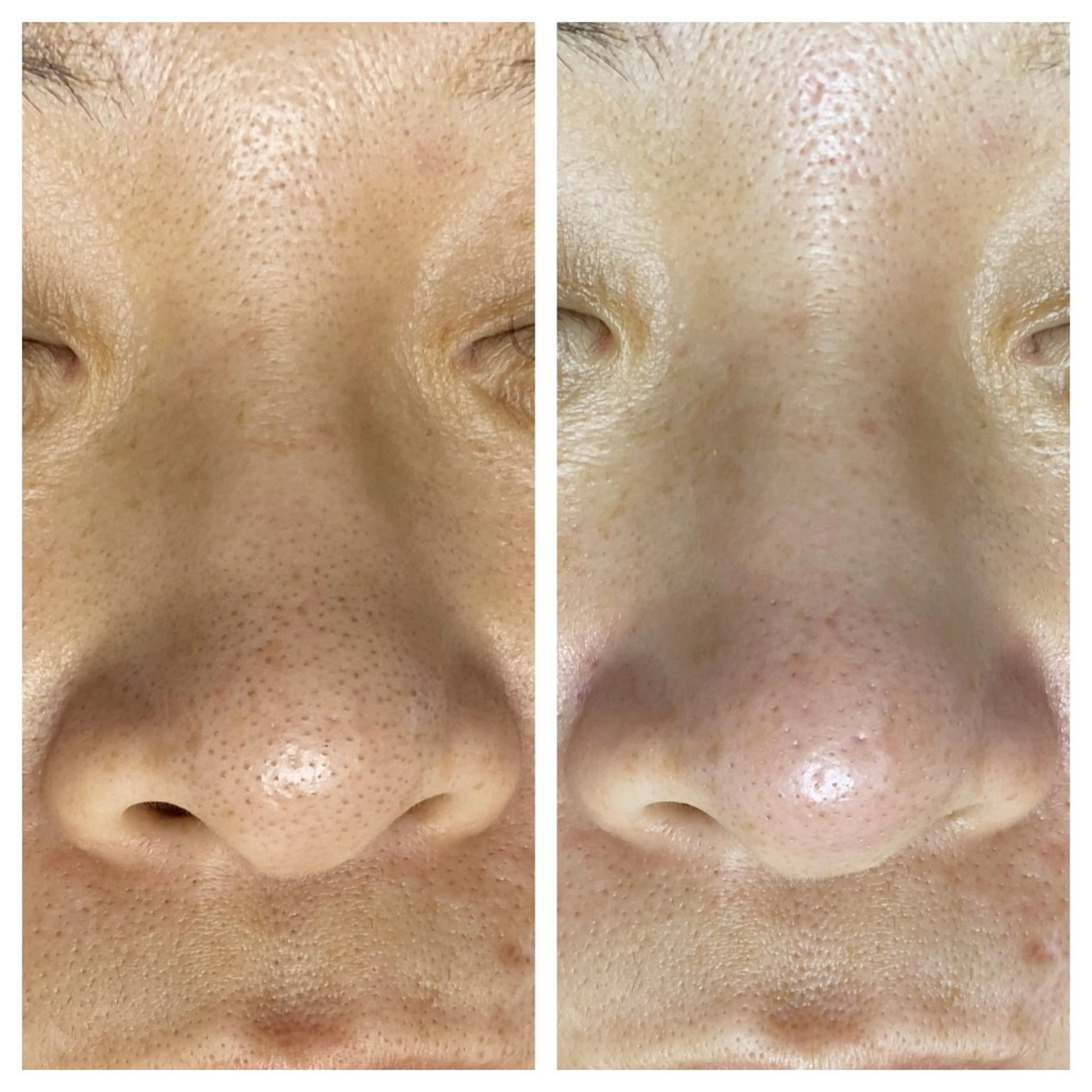 肌質改善 KALANCHOEのエステ・リラクイメージ