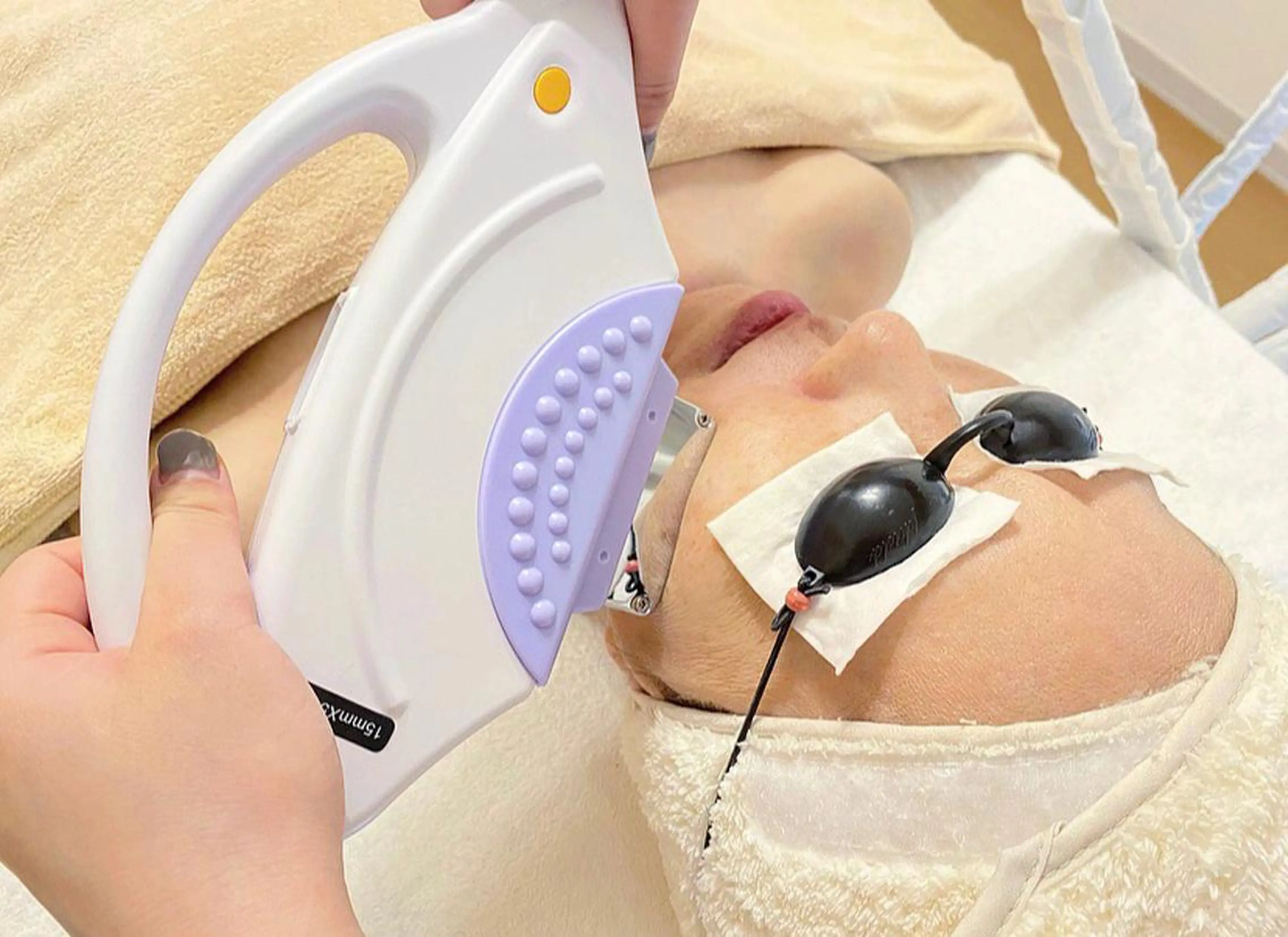 顔(首込み)の写真