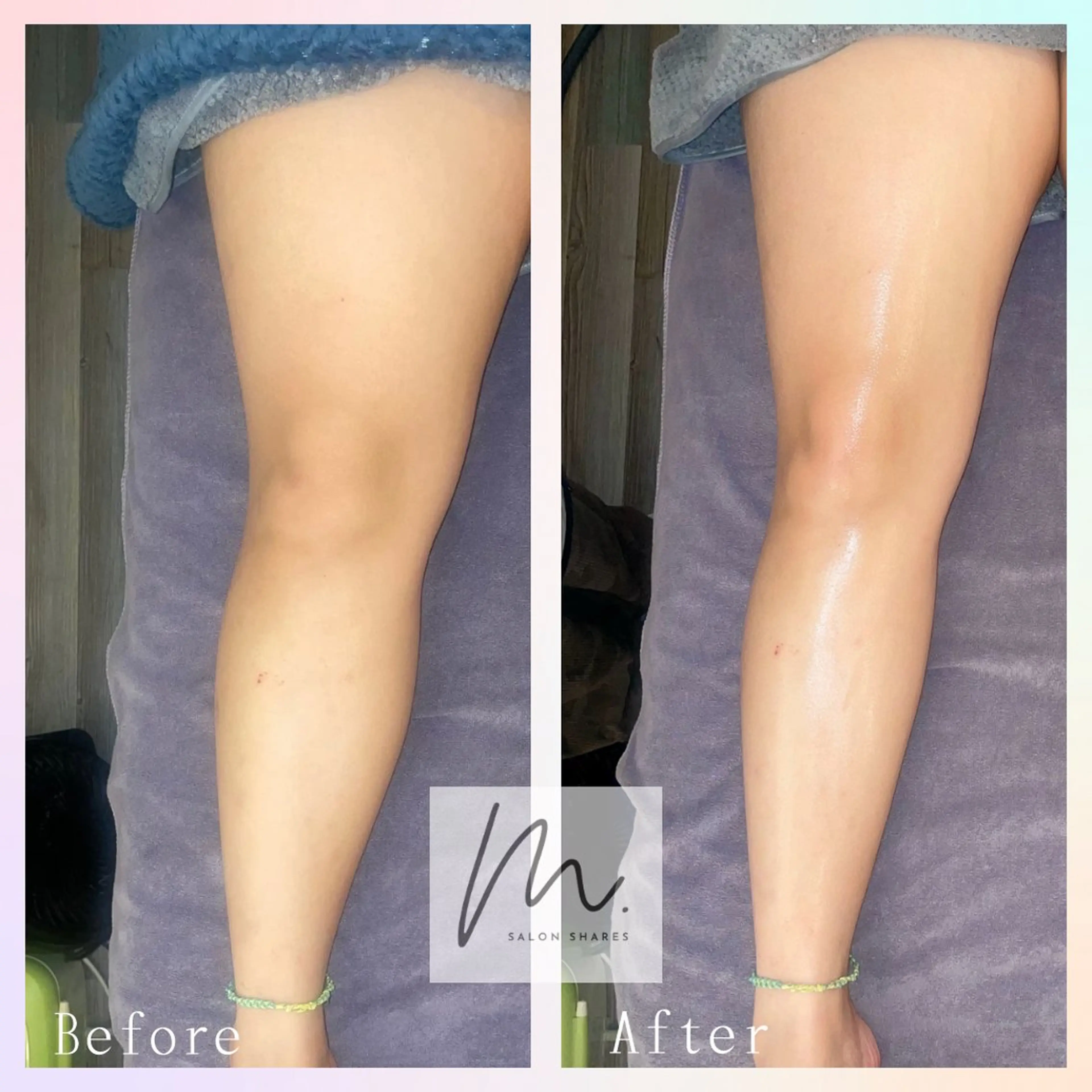 SHARES MADOKAのエステ・リラクイメージ