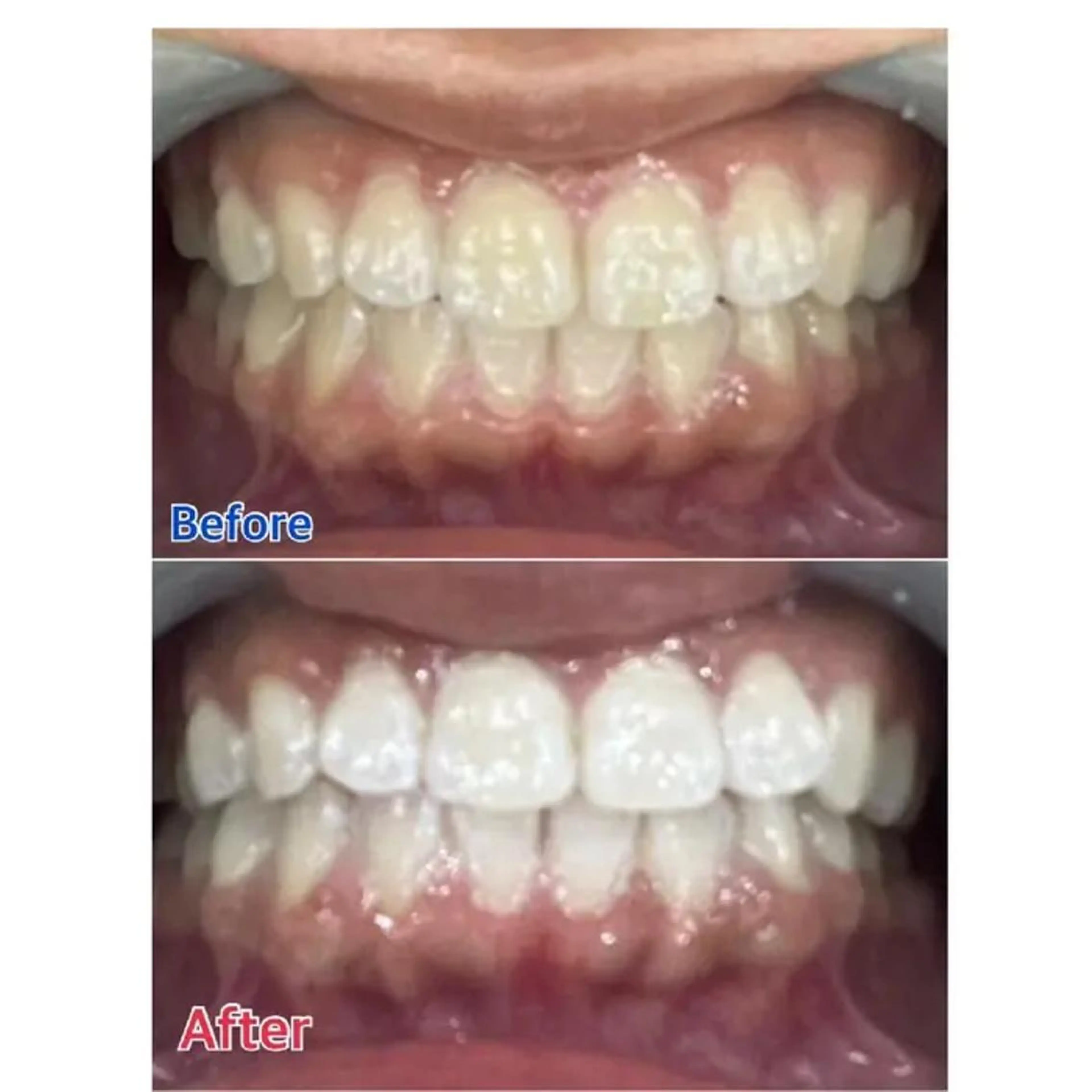 M渋谷 ホワイトニングのエステ・リラクイメージ