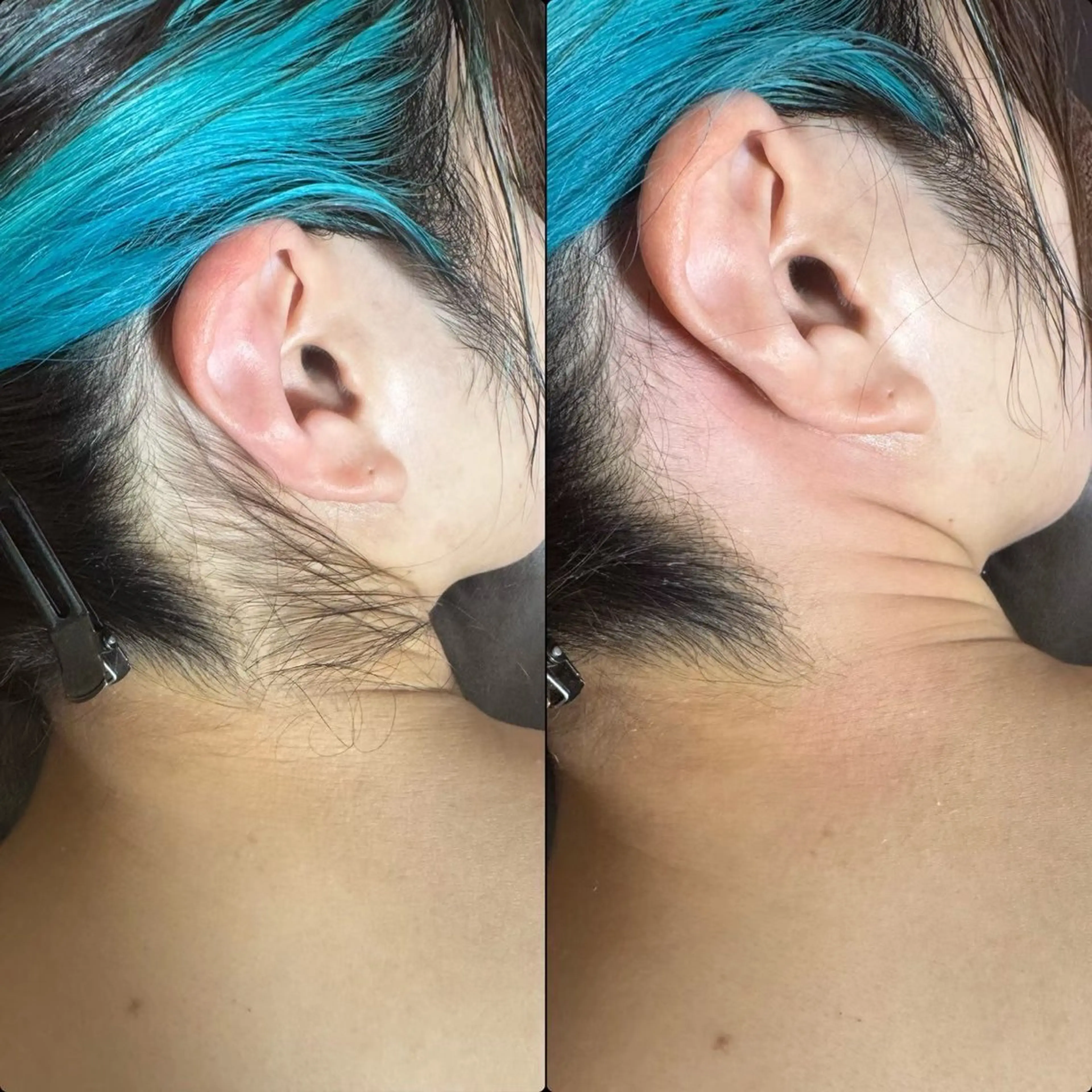 六本木脱毛andS さおりのエステ・リラクイメージ