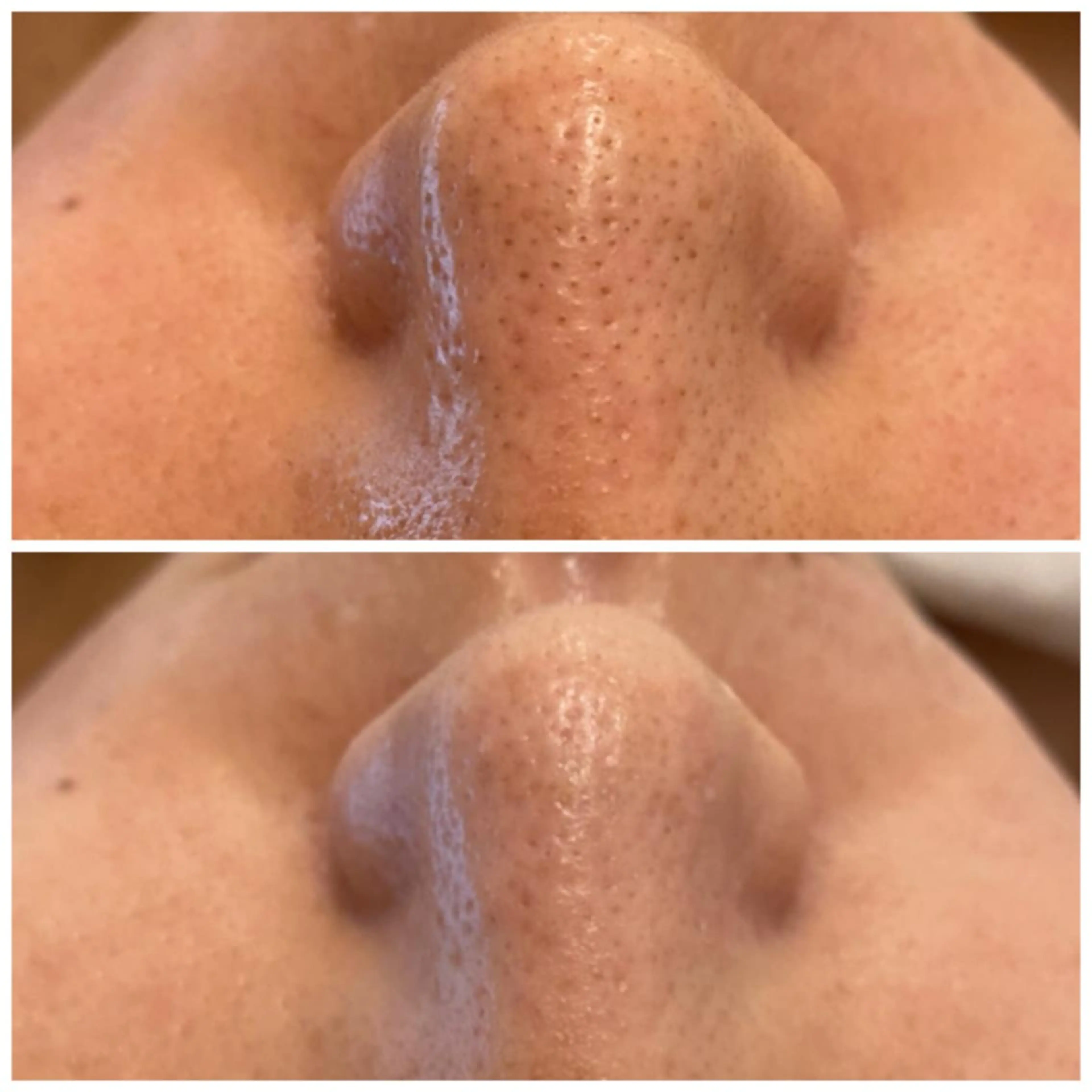 ララ/ハーブ メゾンリュバンのエステ・リラクイメージ