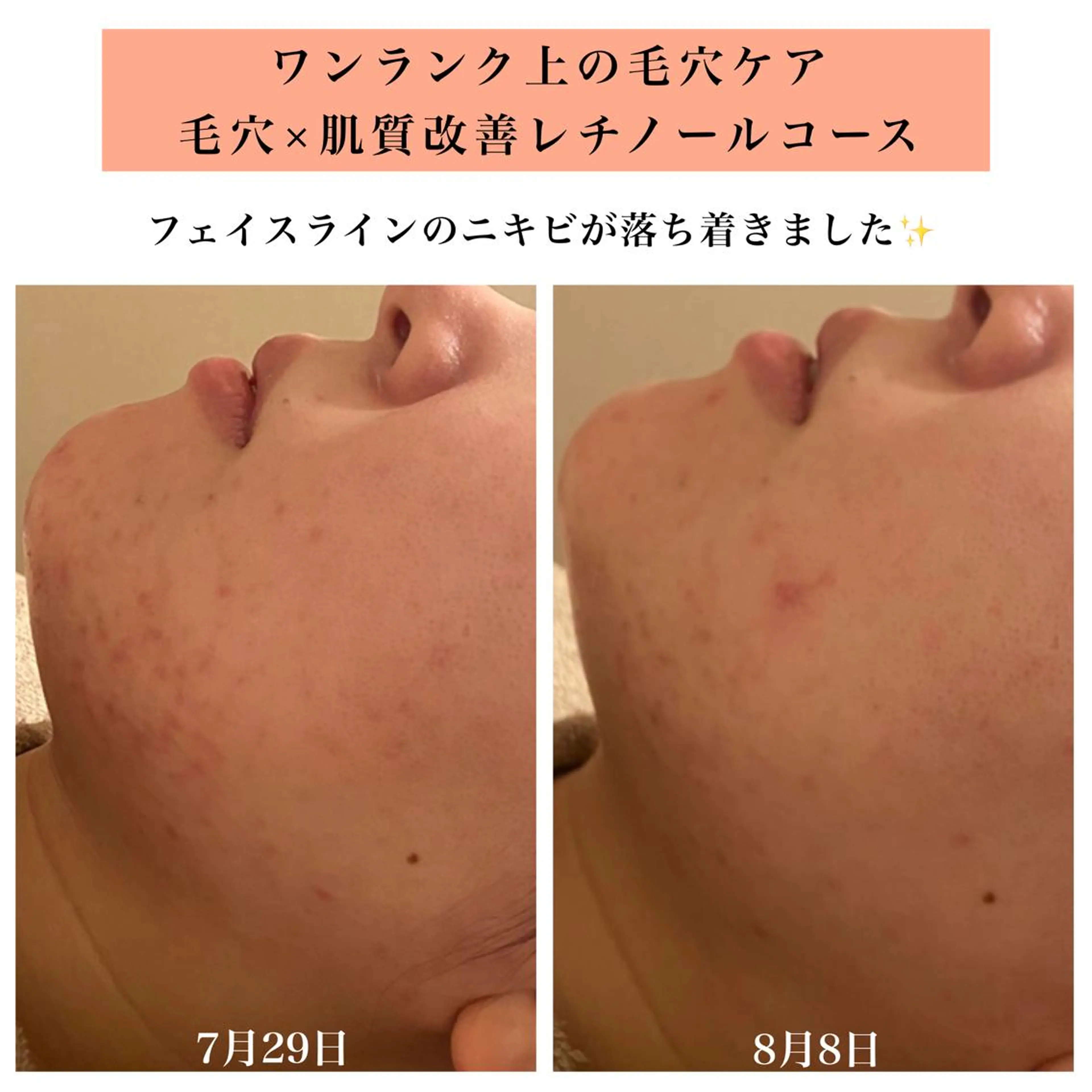 エステ リラク Bellesthe (ベルエステ)のエステ・リラクイメージ