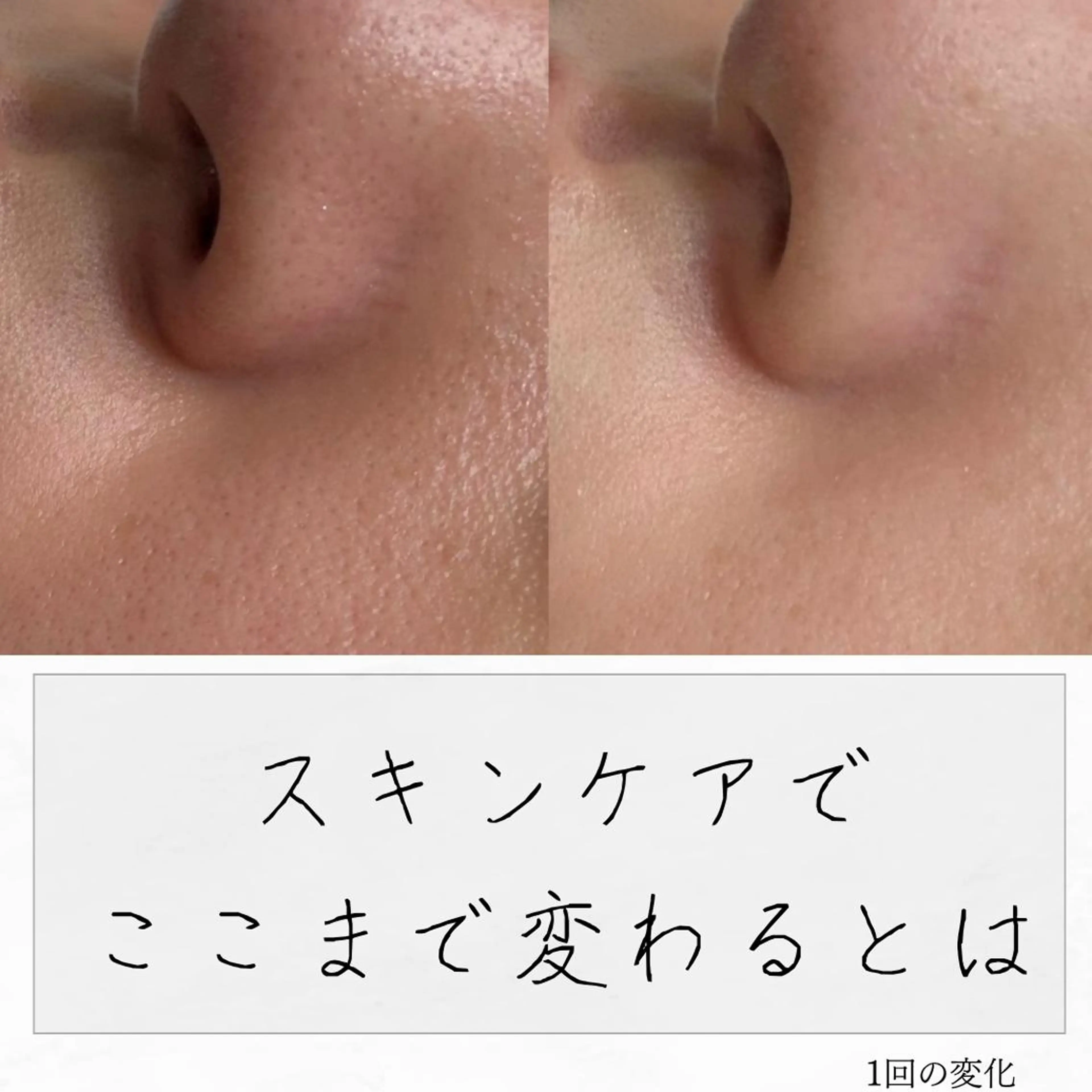 ニキビ経験者が施術 する専門サロン🌻のエステ・リラクイメージ