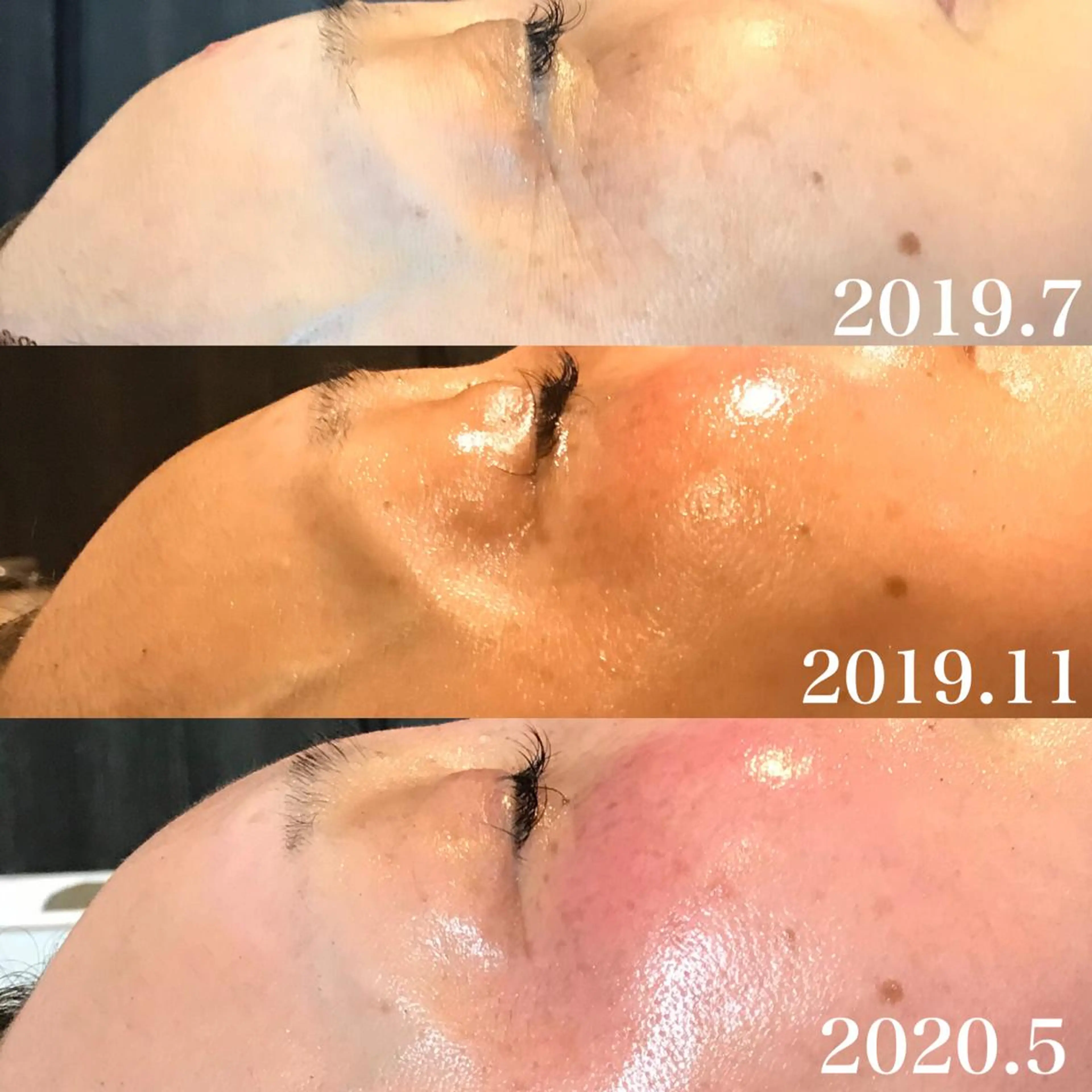 エステ 浜野 恵美のエステ・リラクイメージ