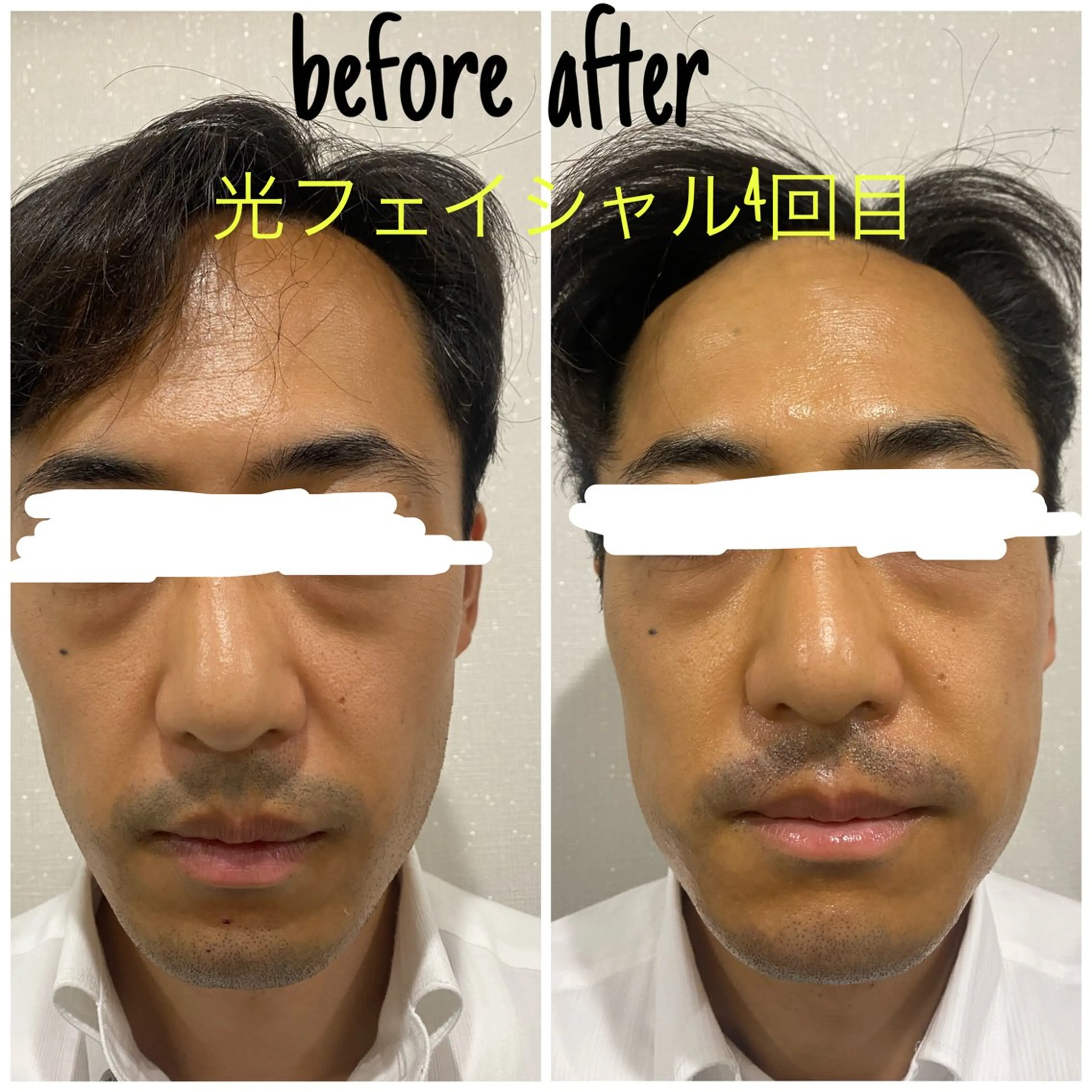 エステ 毛穴洗浄・痩身・脱毛 /アルカンジュのエステ・リラクイメージ