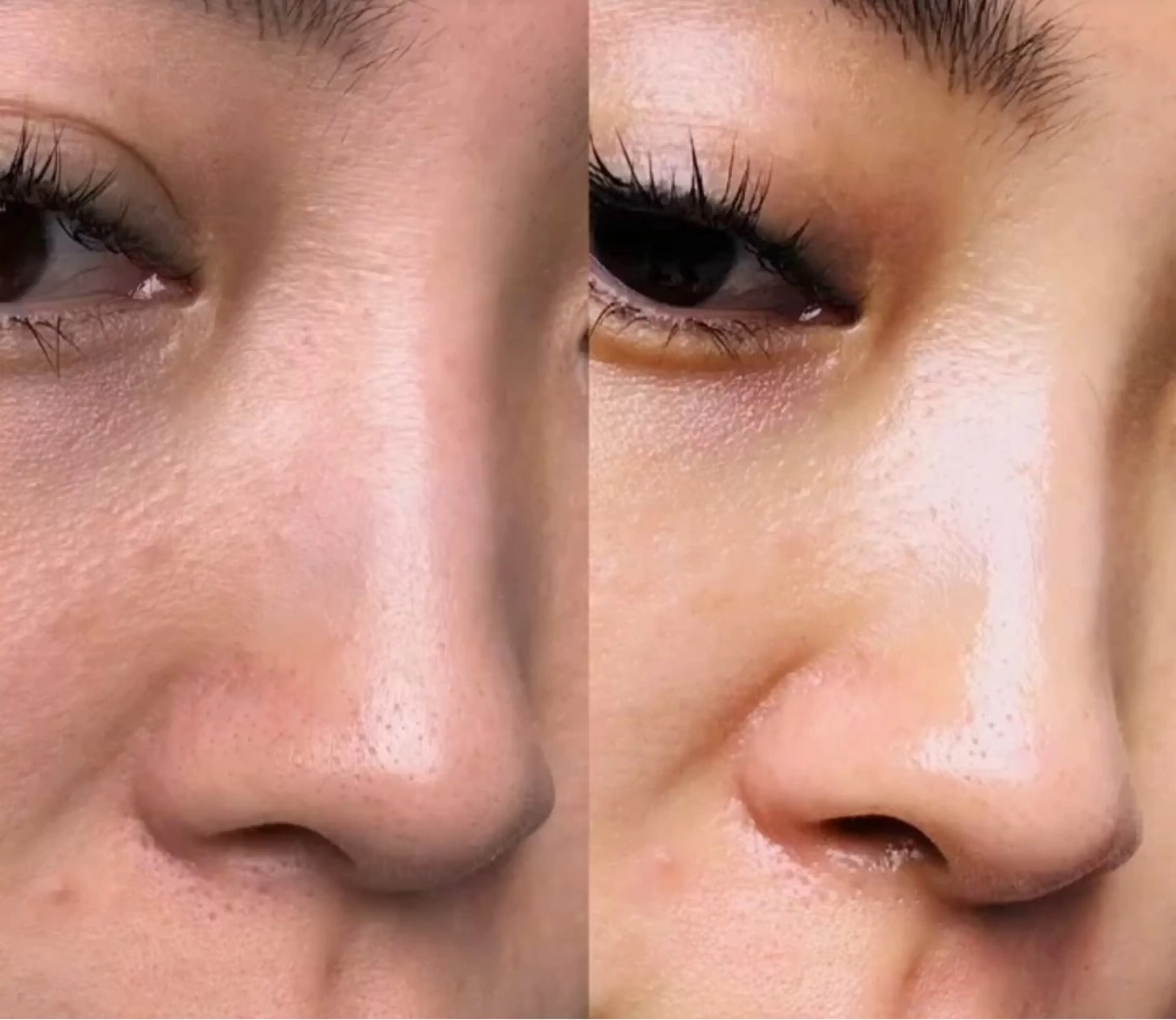 エステ リラク 愛維美水光美肌専門店 メンズレディースokのエステ・リラクイメージ