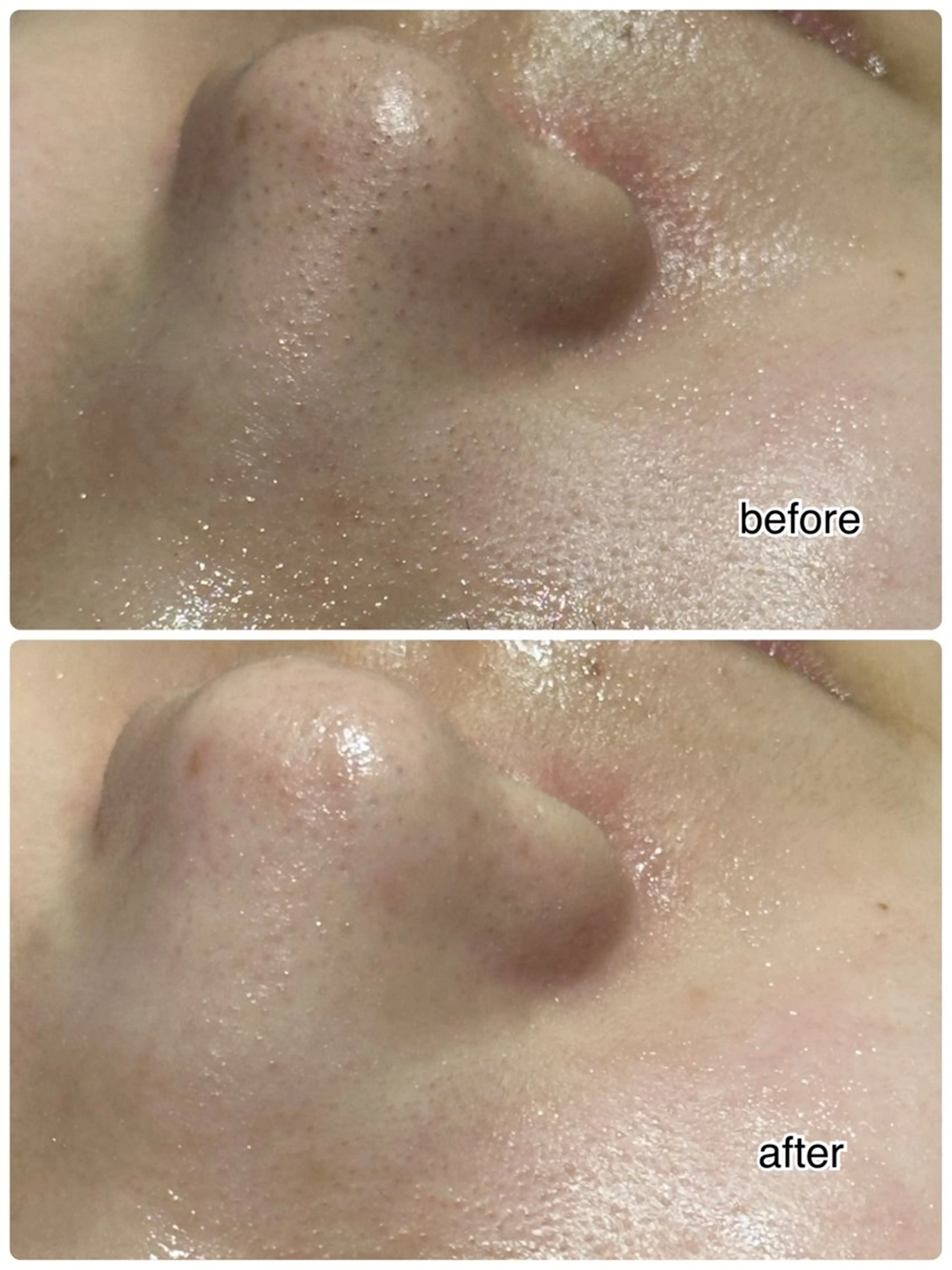 ENCHANT 脱毛.小顔.毛穴のエステ・リラクイメージ