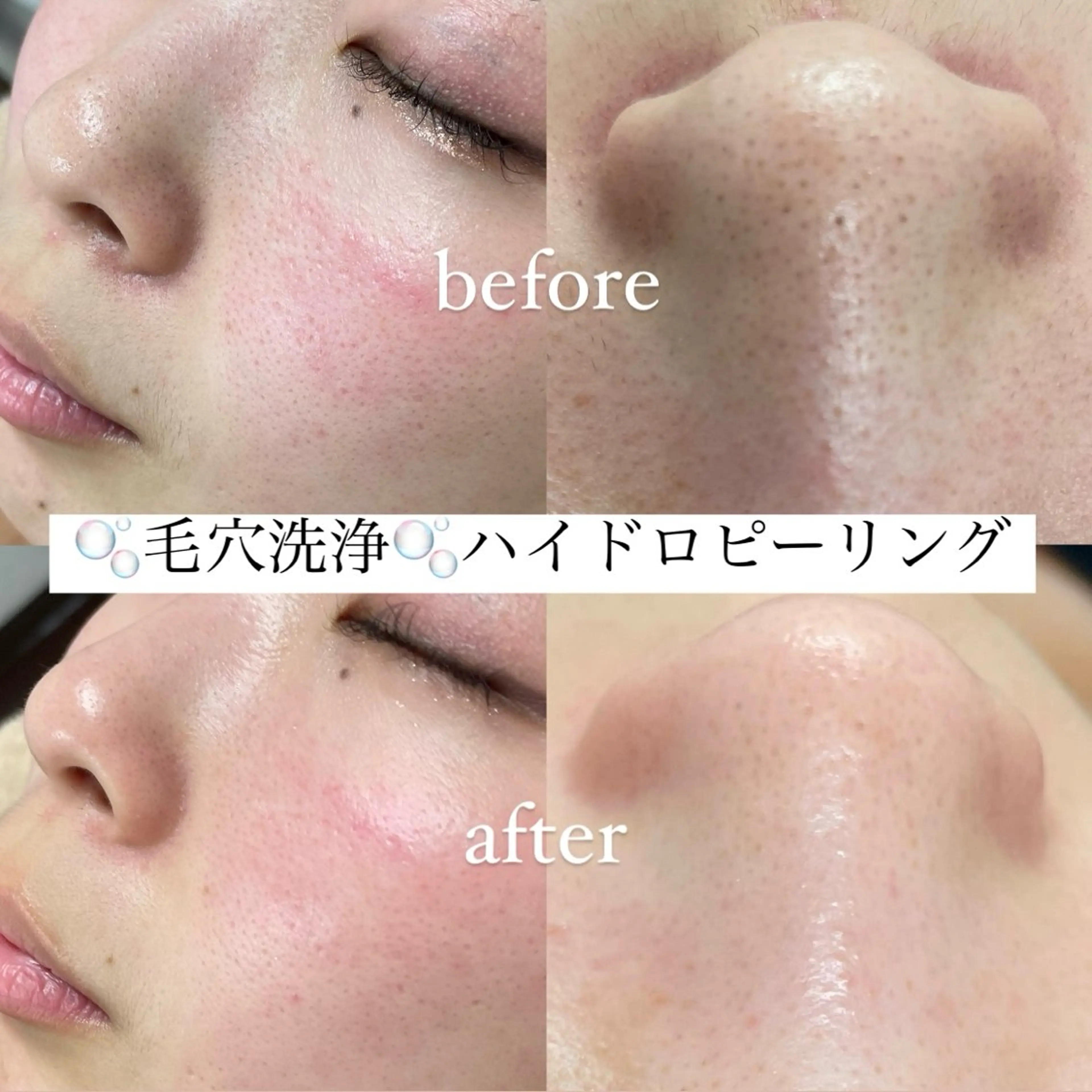 玉木 愛の眉毛・アイブロウイメージ