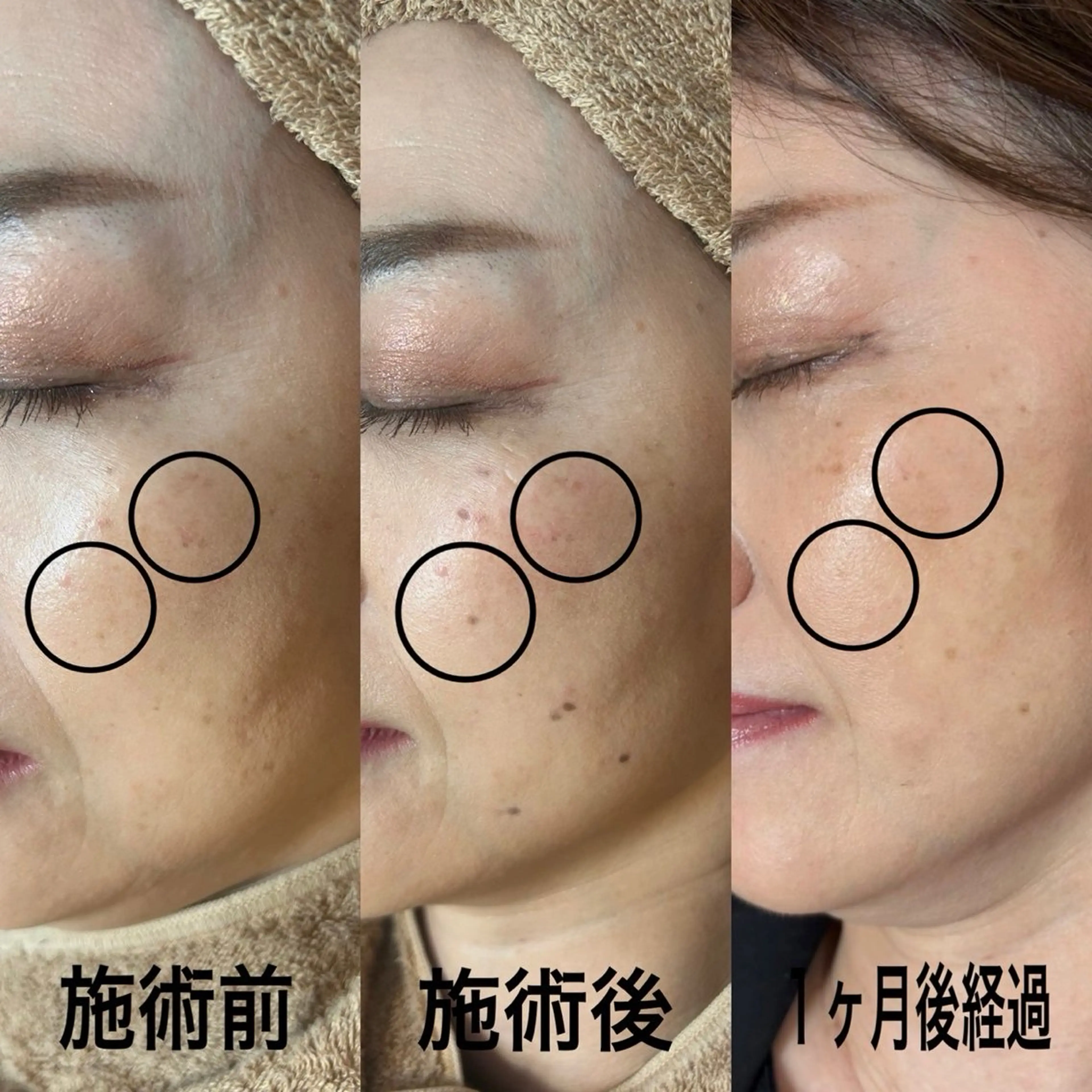 エステ LUMY GRATiAEのエステ・リラクイメージ