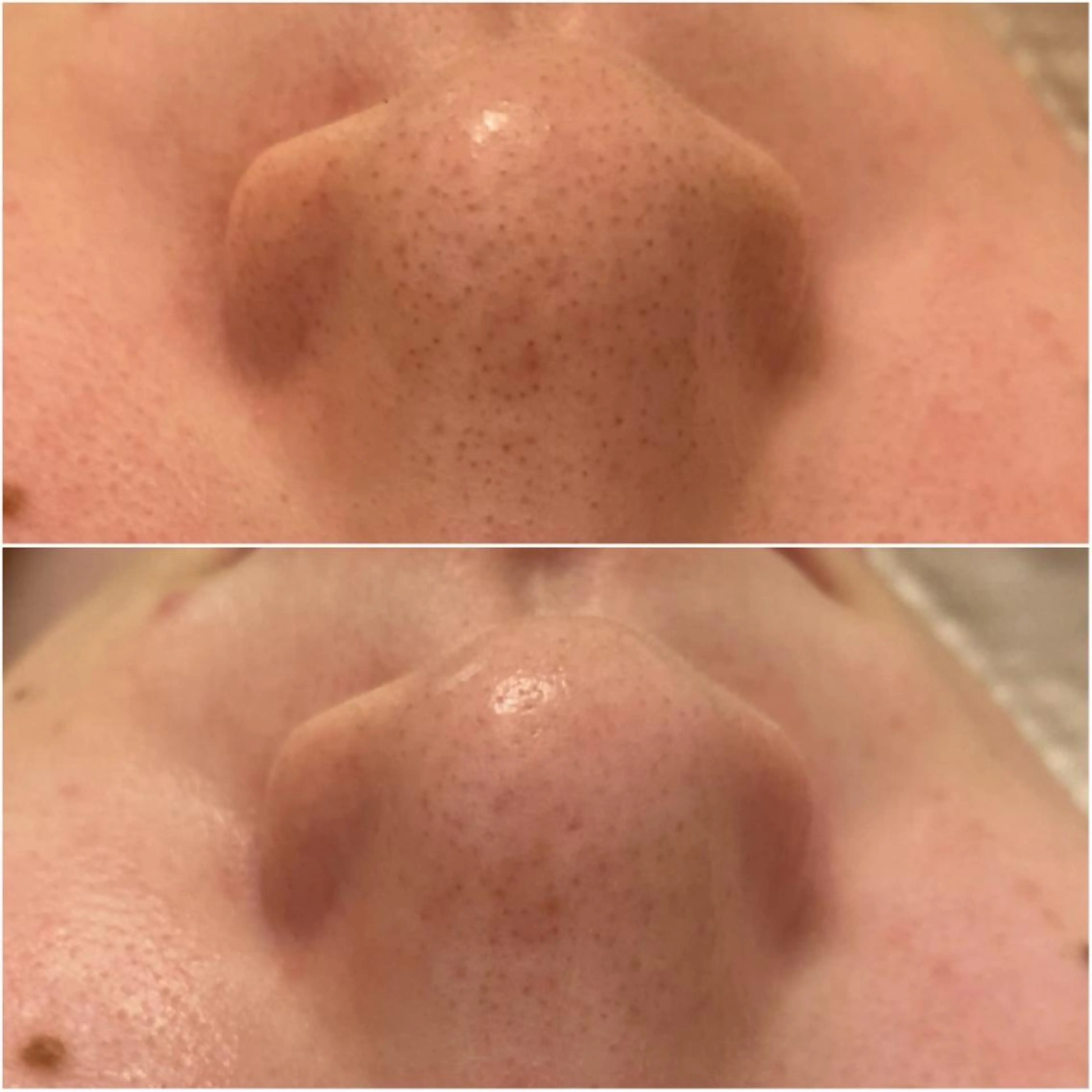 ララ/ハーブ メゾンリュバンのエステ・リラクイメージ