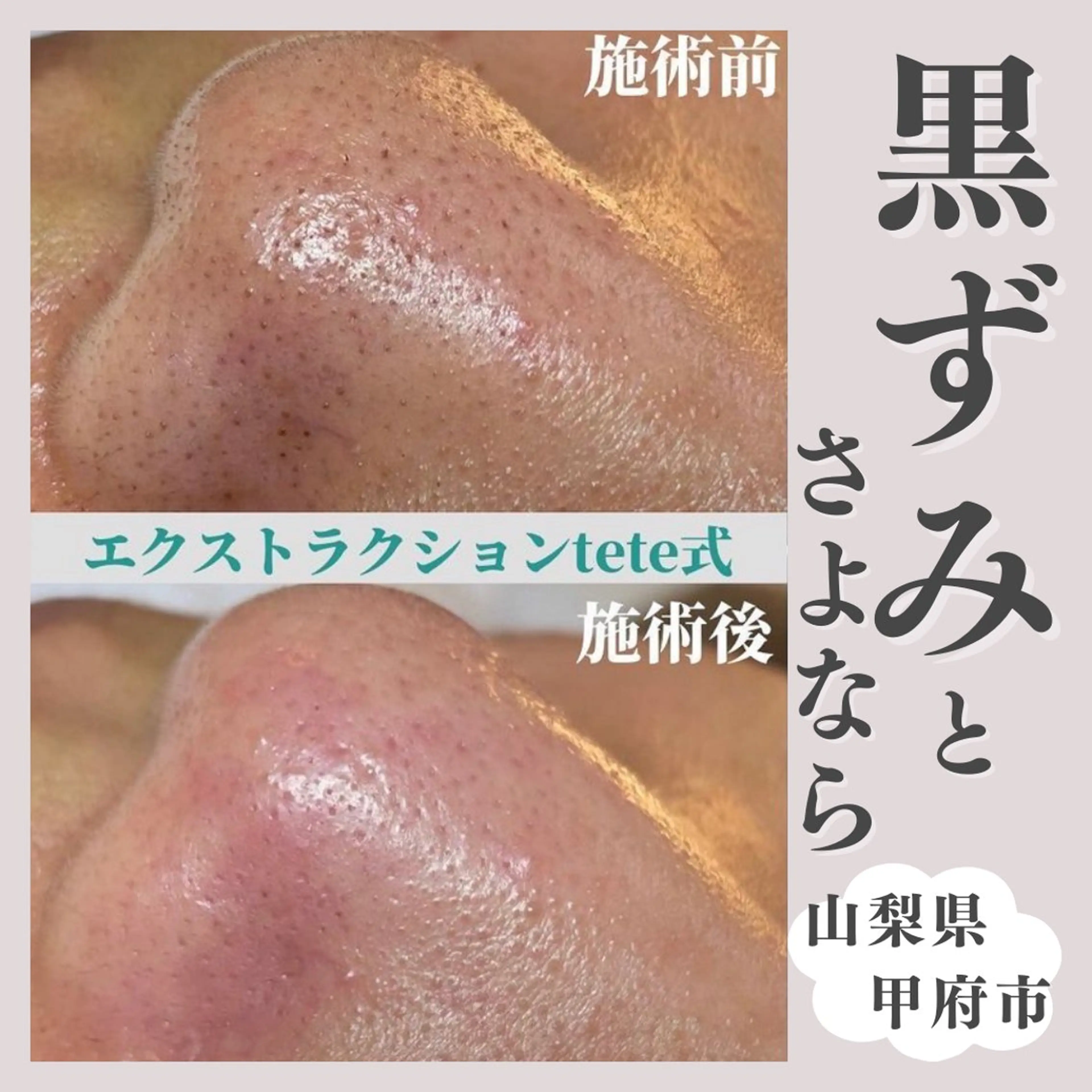 salon MUSUBUのエステ・リラクイメージ