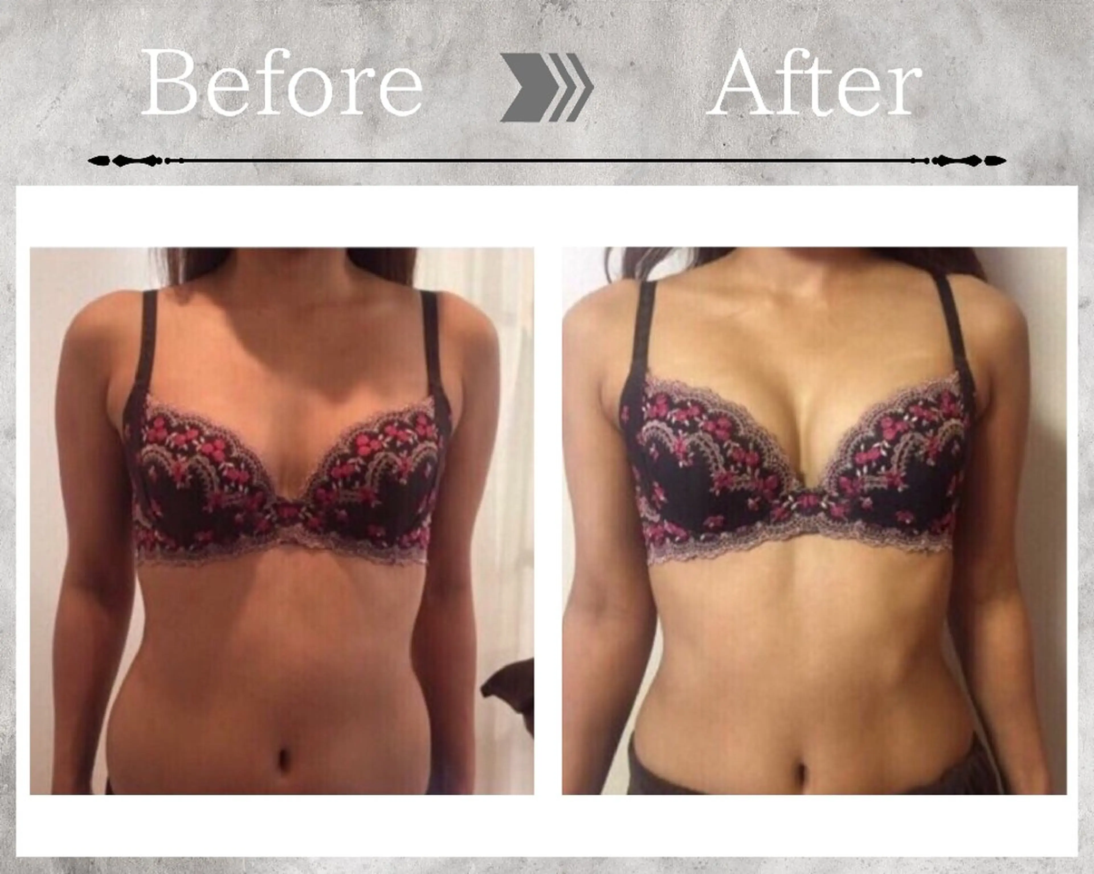 その他 【バストケアサロン】 Feliz フェリスのエステ・リラクイメージ