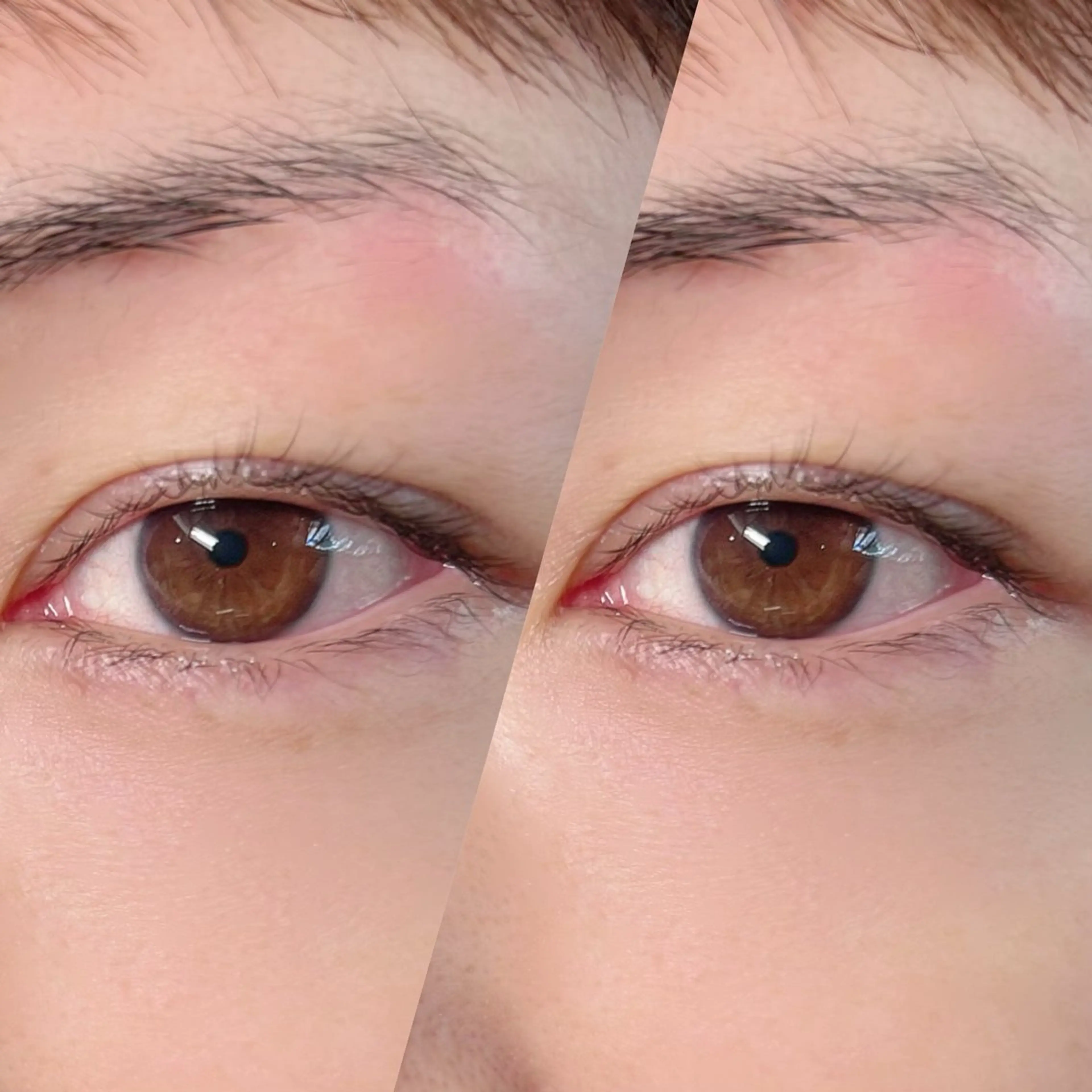 マツエク・マツパ まつげパーマ マツパ beautyessence都立大学所属・温熱ケア&まつパ 都立大学駅のエステ・リラクイメージ