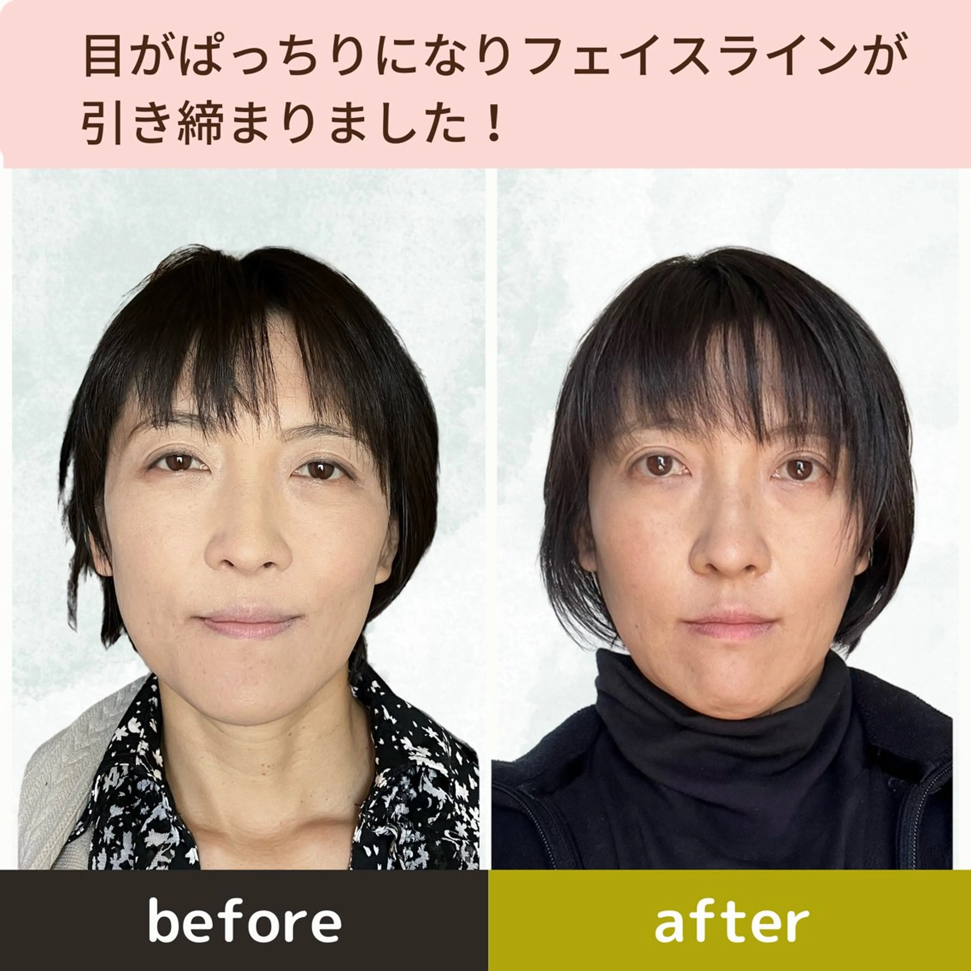 エステ リラク 小顔&ヘッドスパ/ もりもとまきみのエステ・リラクイメージ