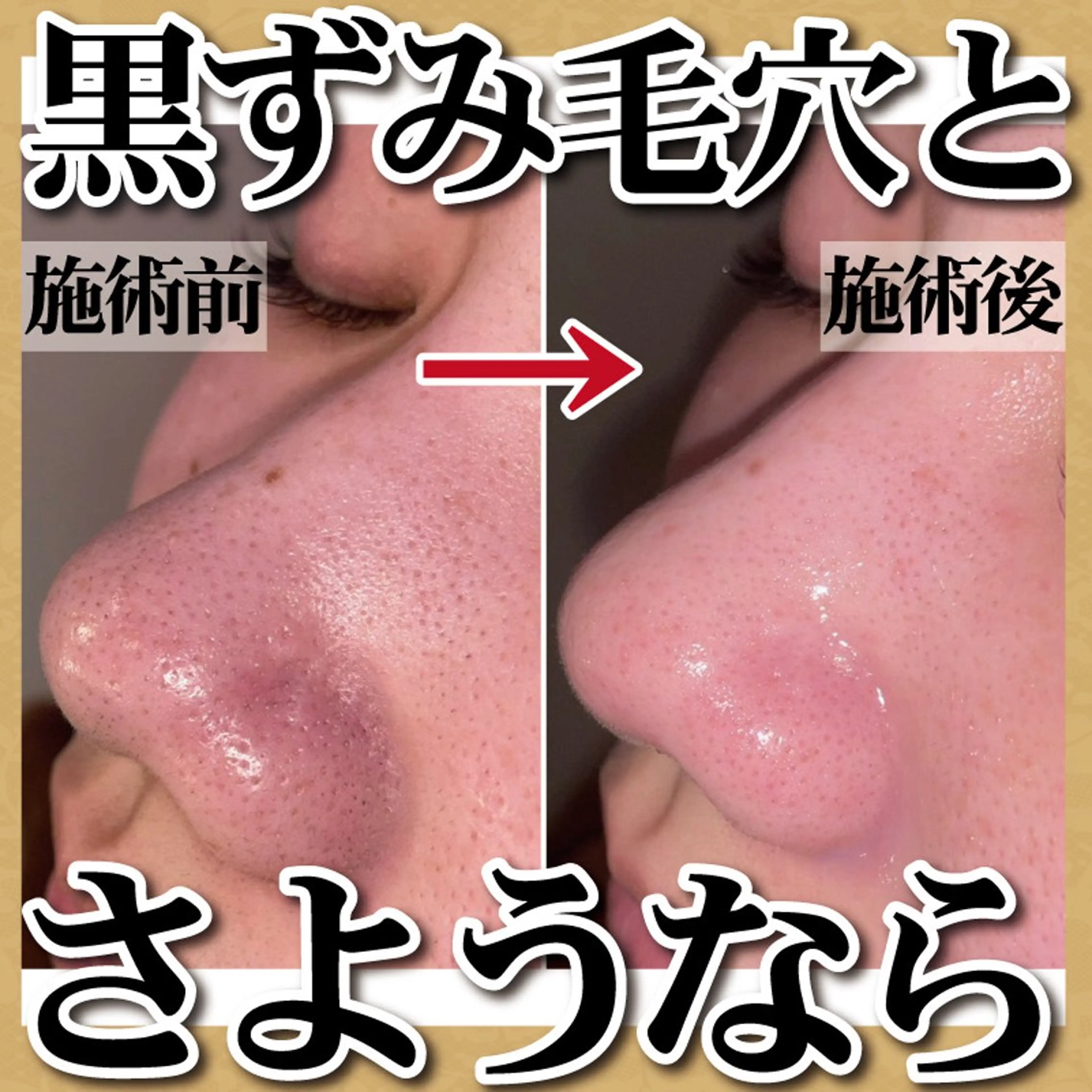 エステ 脱毛 TOWA大宮のエステ・リラクイメージ