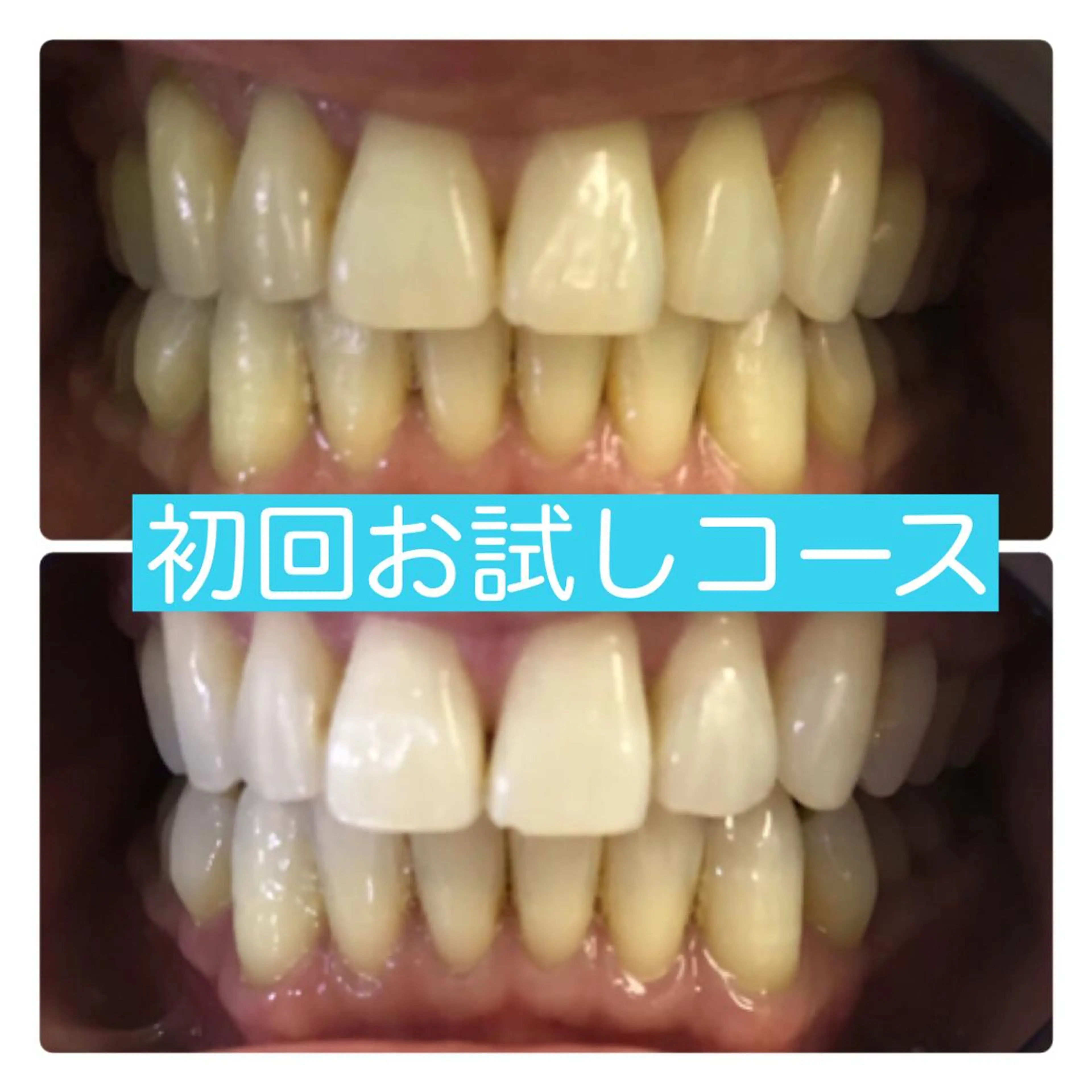 ホワイトニングルーム 横浜店のその他イメージ