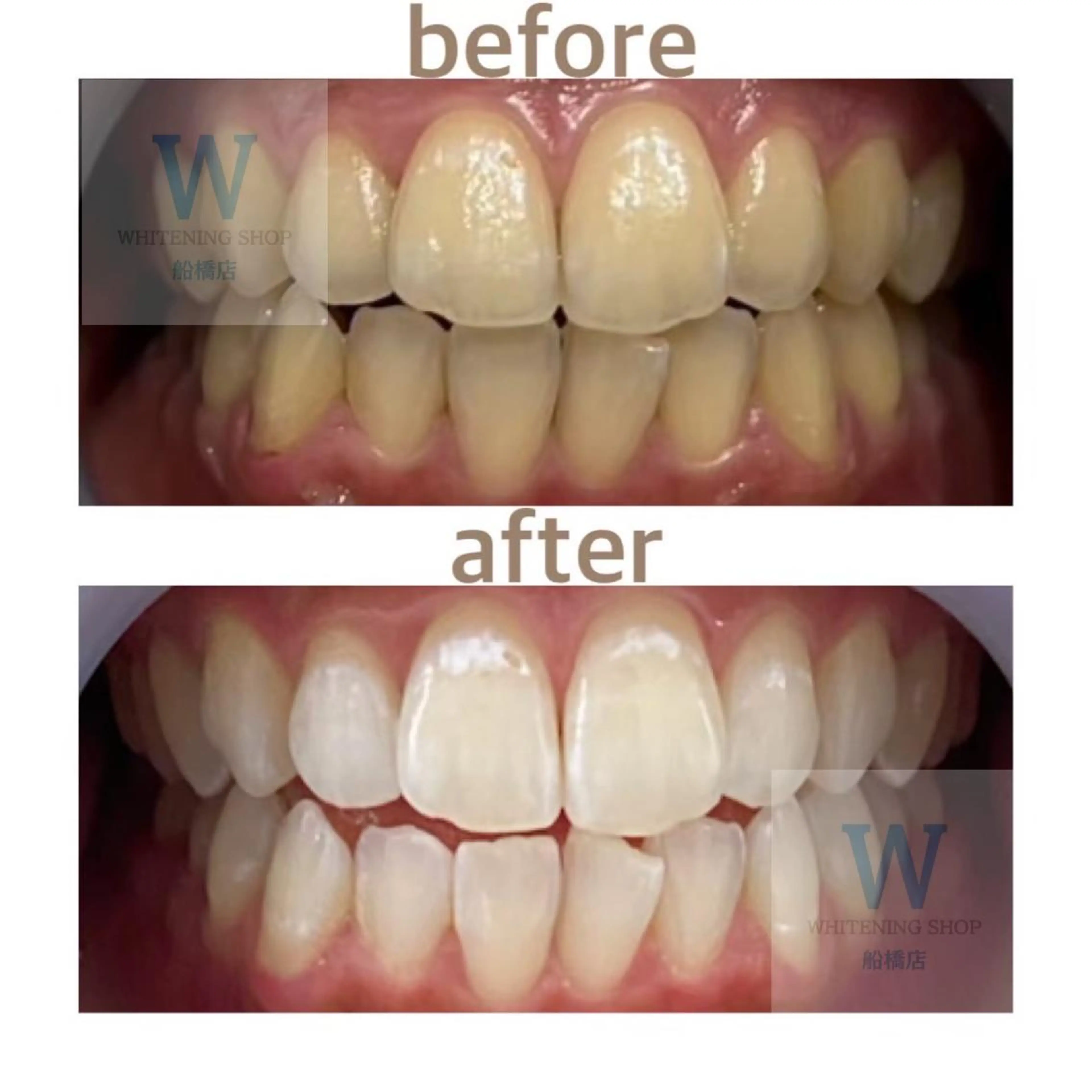 エステ リラク ホワイトニング ショップ船橋２号店のエステ・リラクイメージ