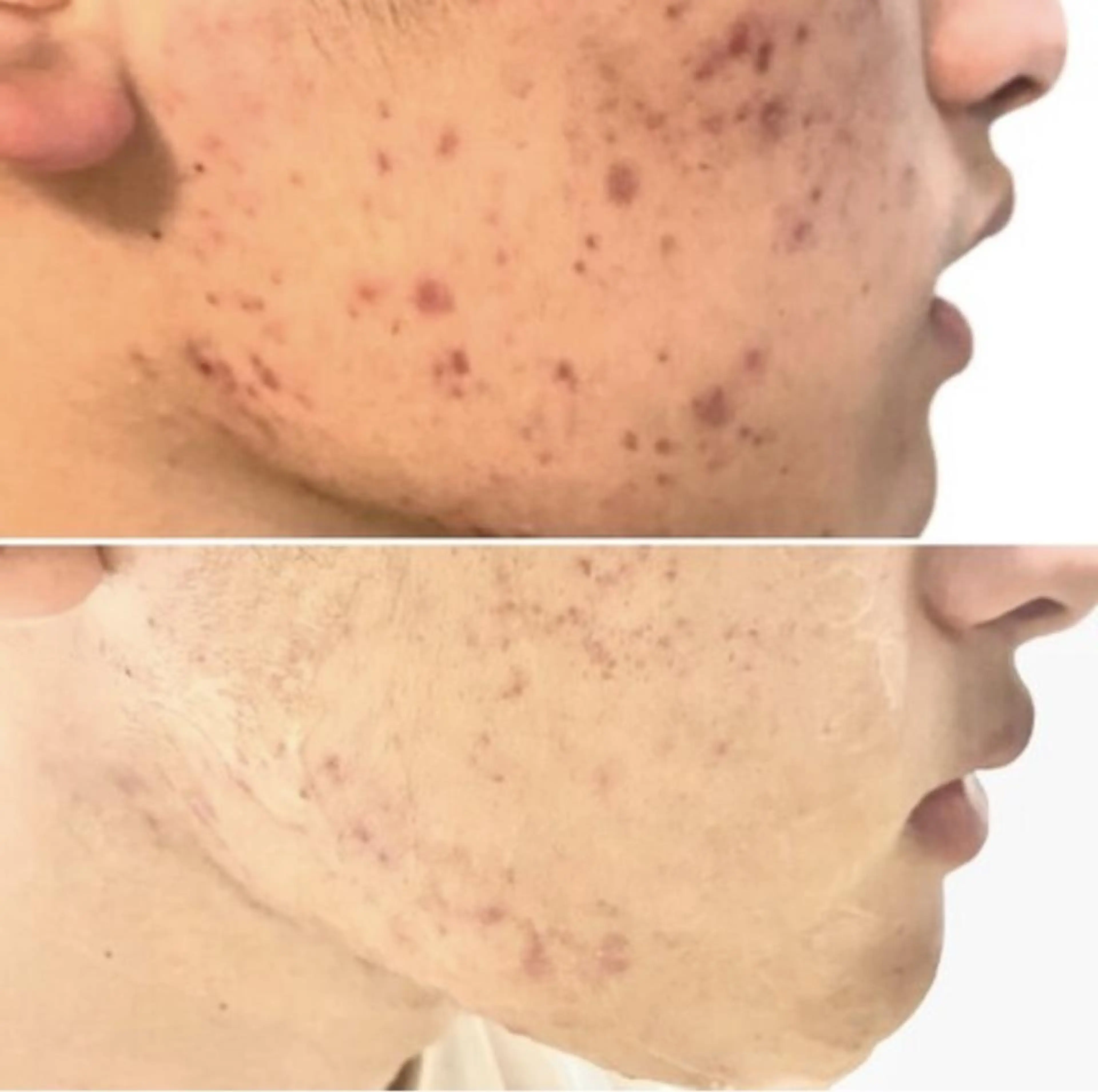 メンズ キッズ エステ Epina 千葉店 【エピナ】のエステ・リラクイメージ