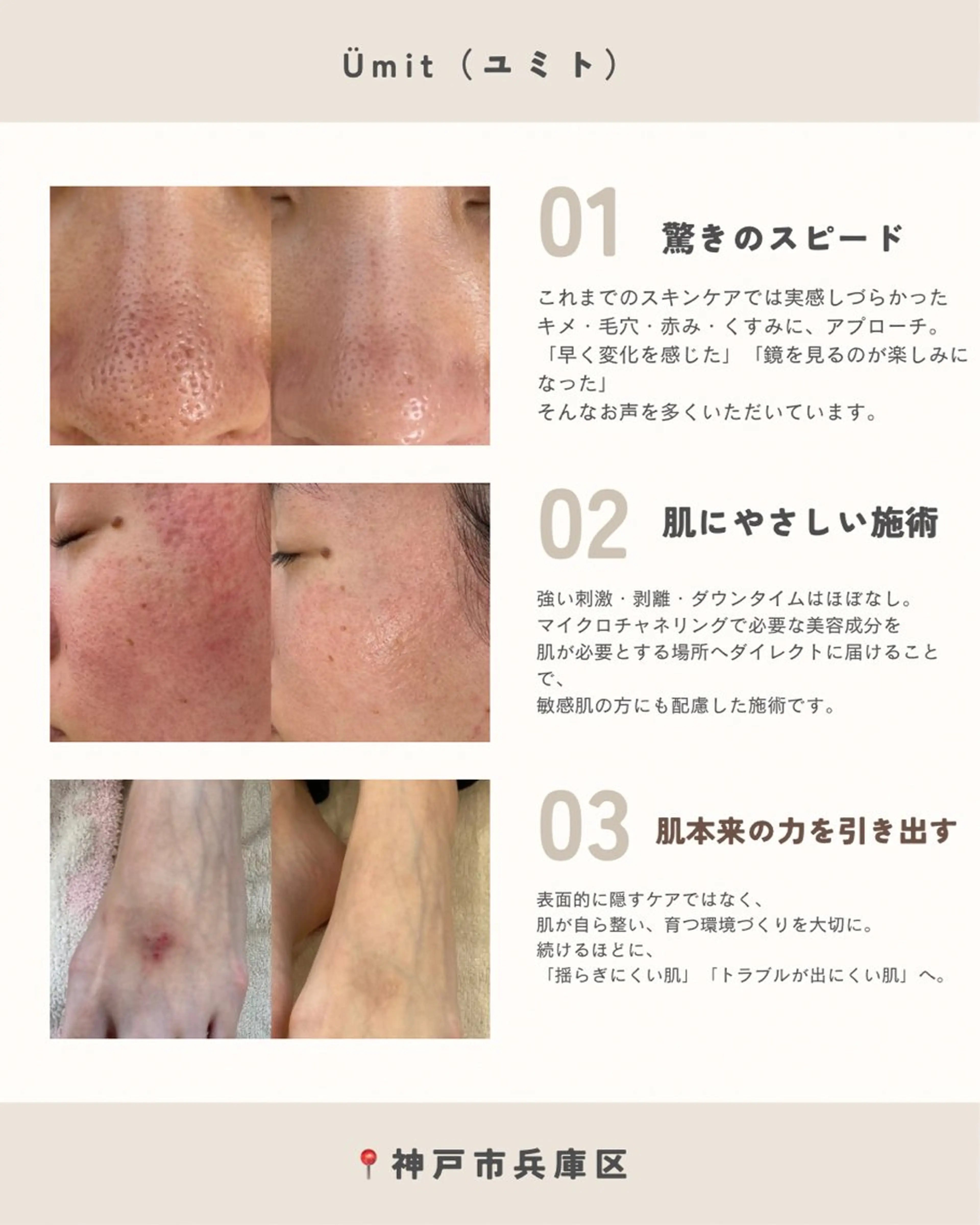 エステ Ümit（ユミト） プロセルセラピーズのネイルデザイン