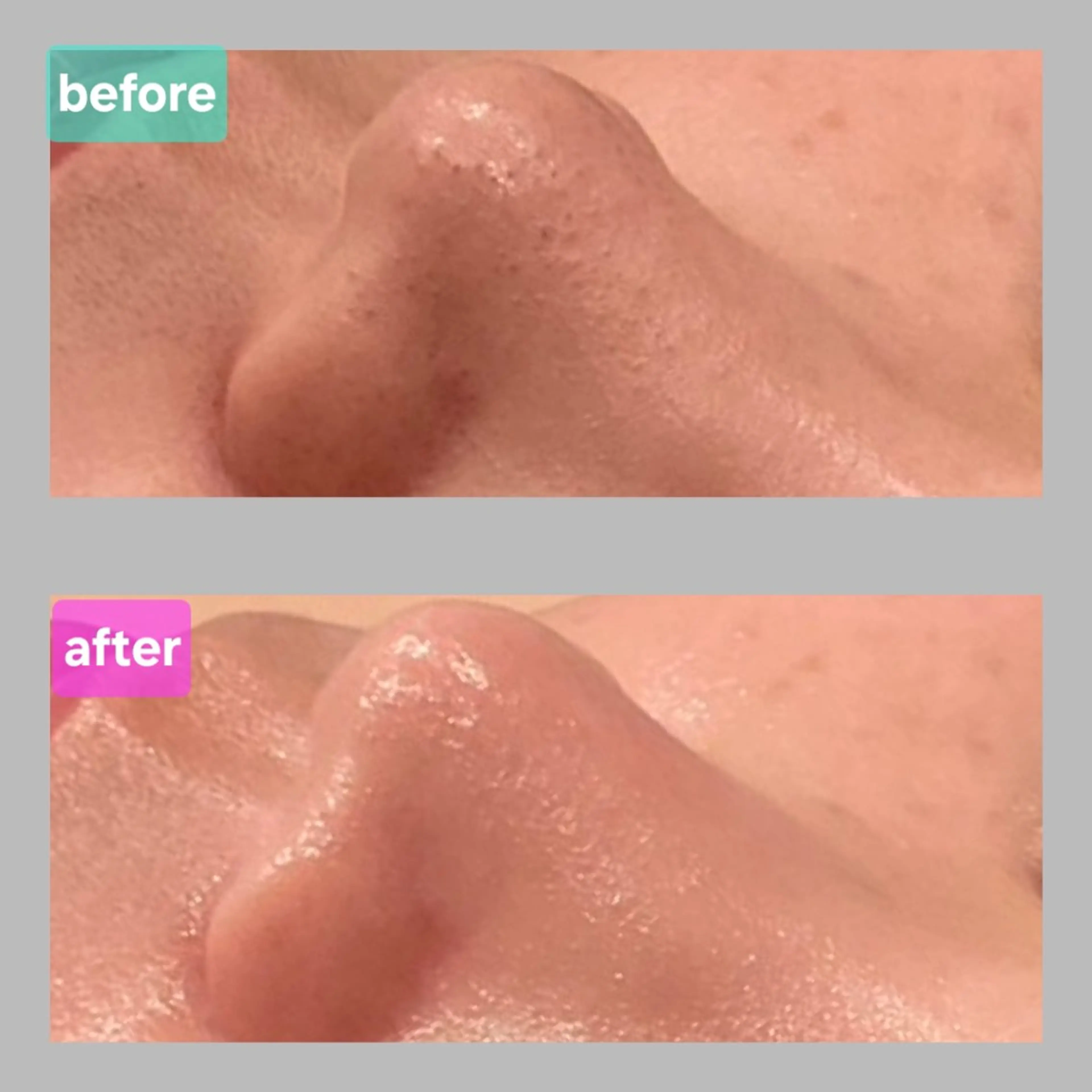 エステ ベル チェリカ 三城のエステ・リラクイメージ