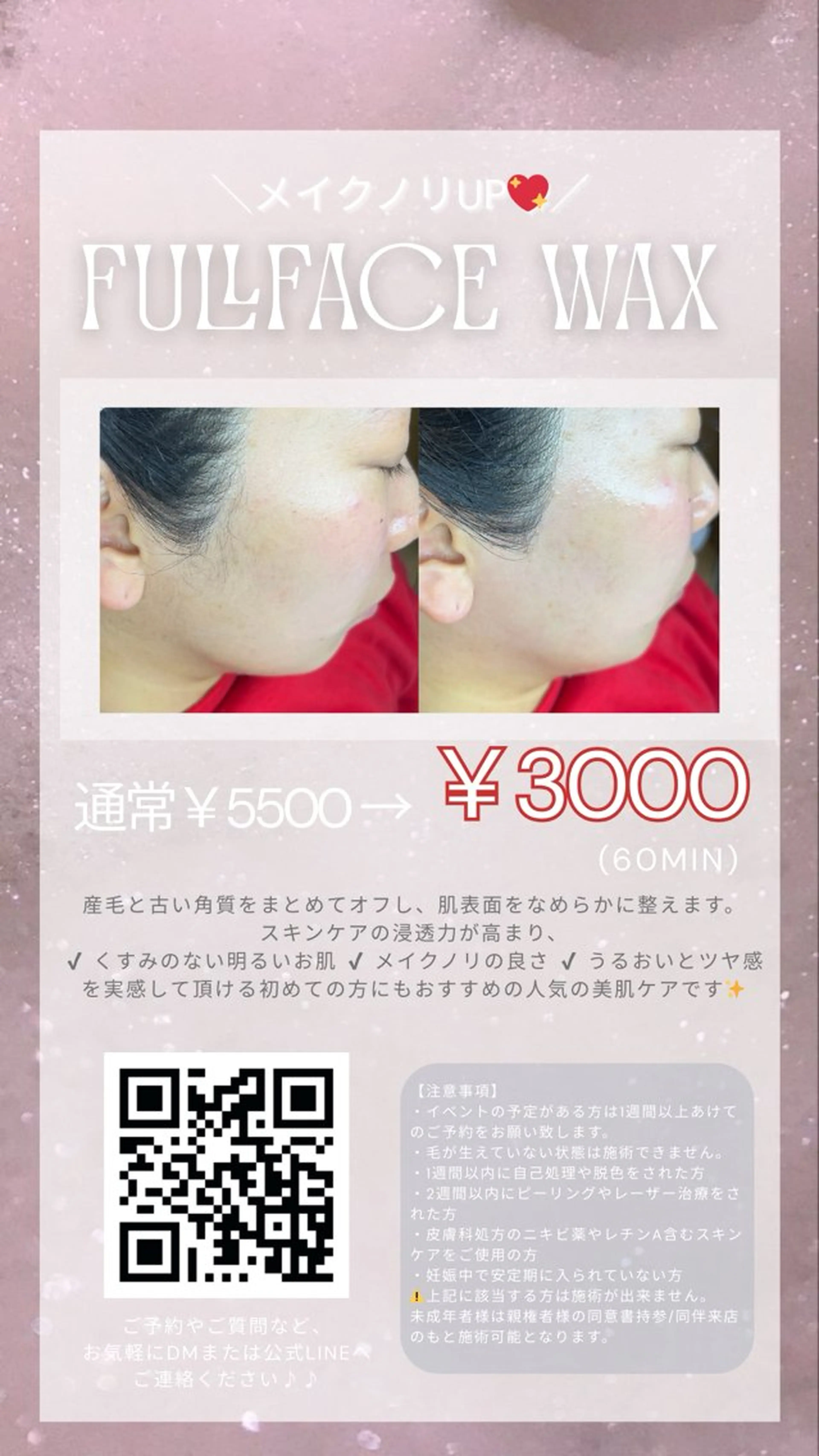 メイクノリandスキンケア浸透力up⤴️【ツヤ肌フルフェイスワックス脱毛‎🤍】の写真