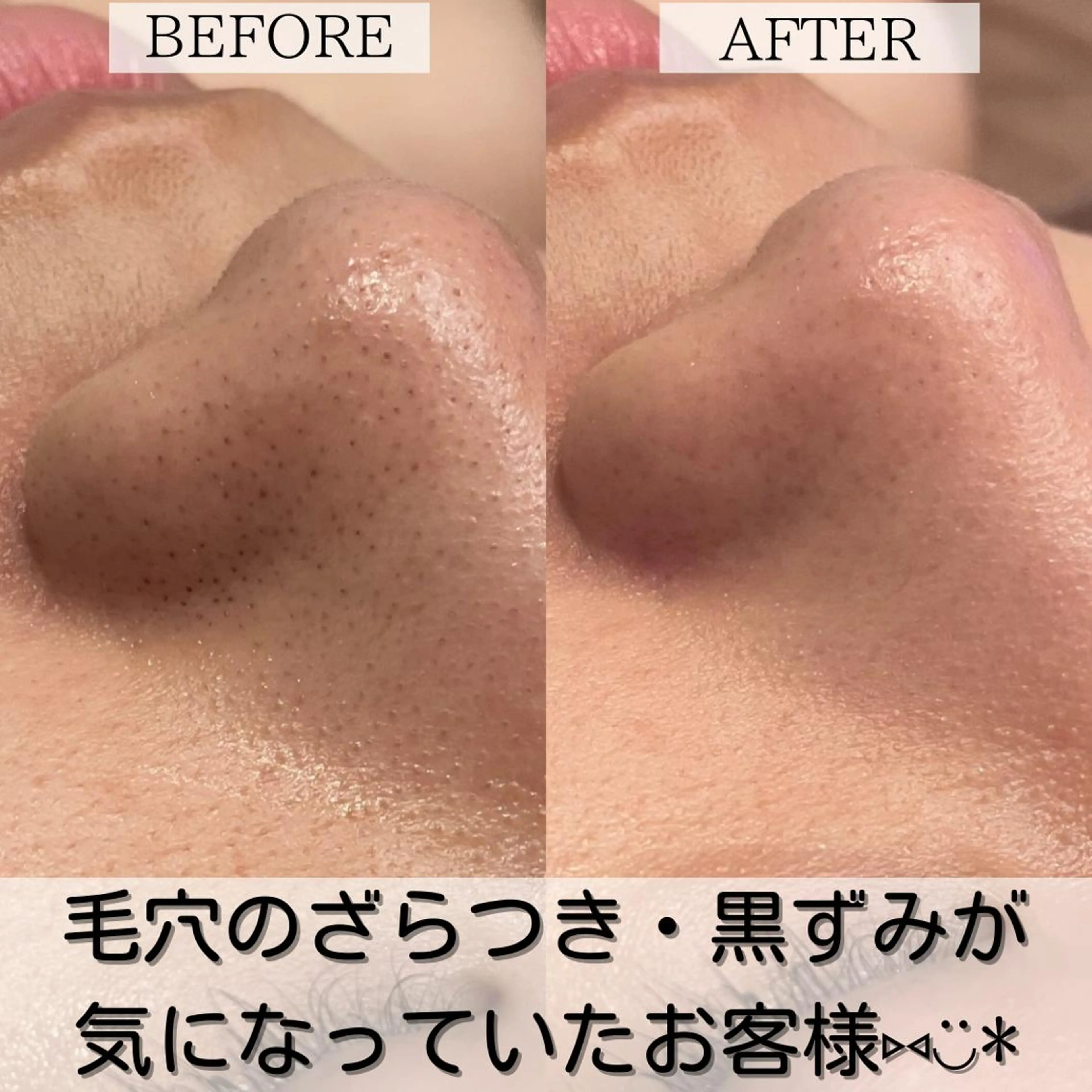 エステ 小顔・美肌 ルミエールのエステ・リラクイメージ