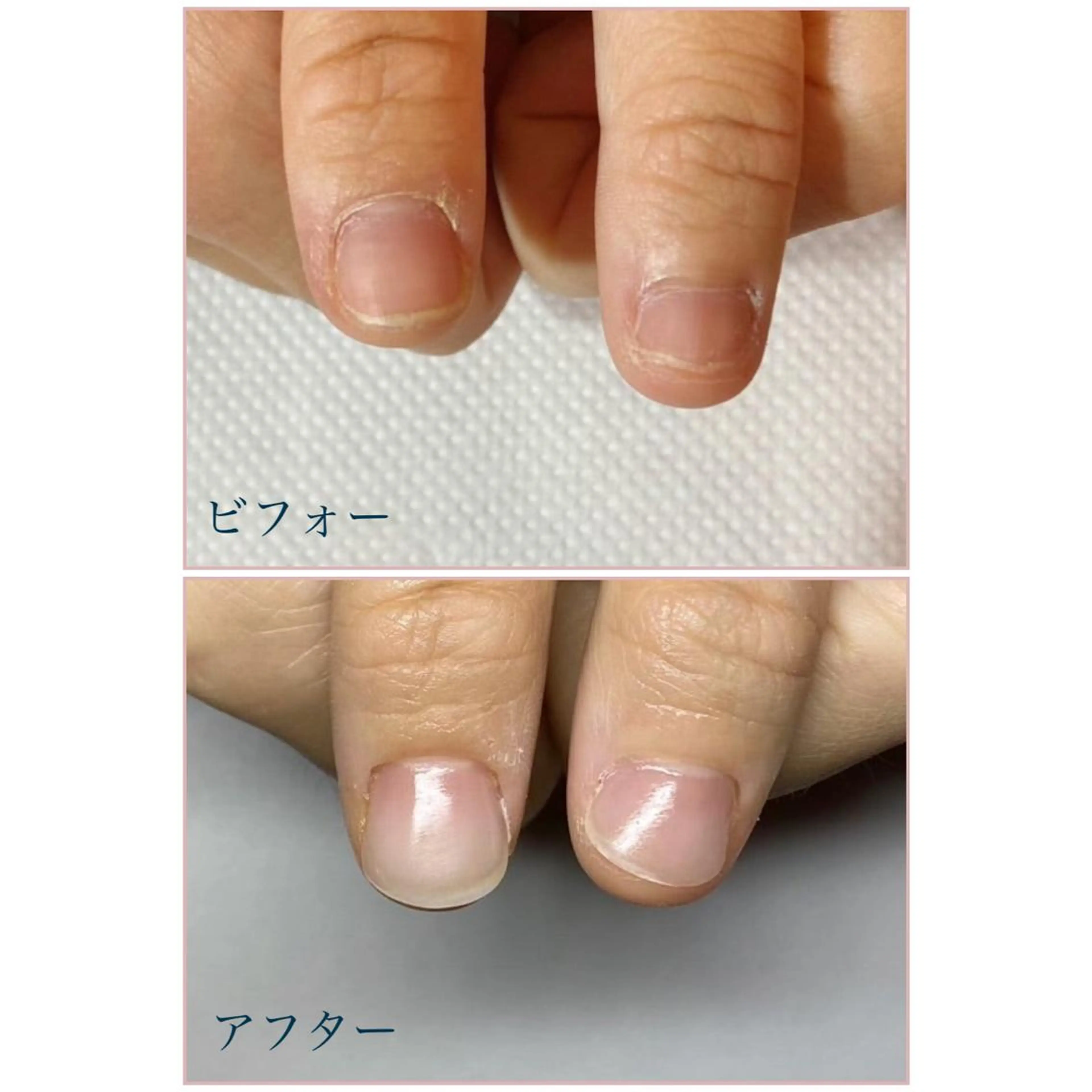 ネイル ネイルサロン アリュームのネイルデザイン