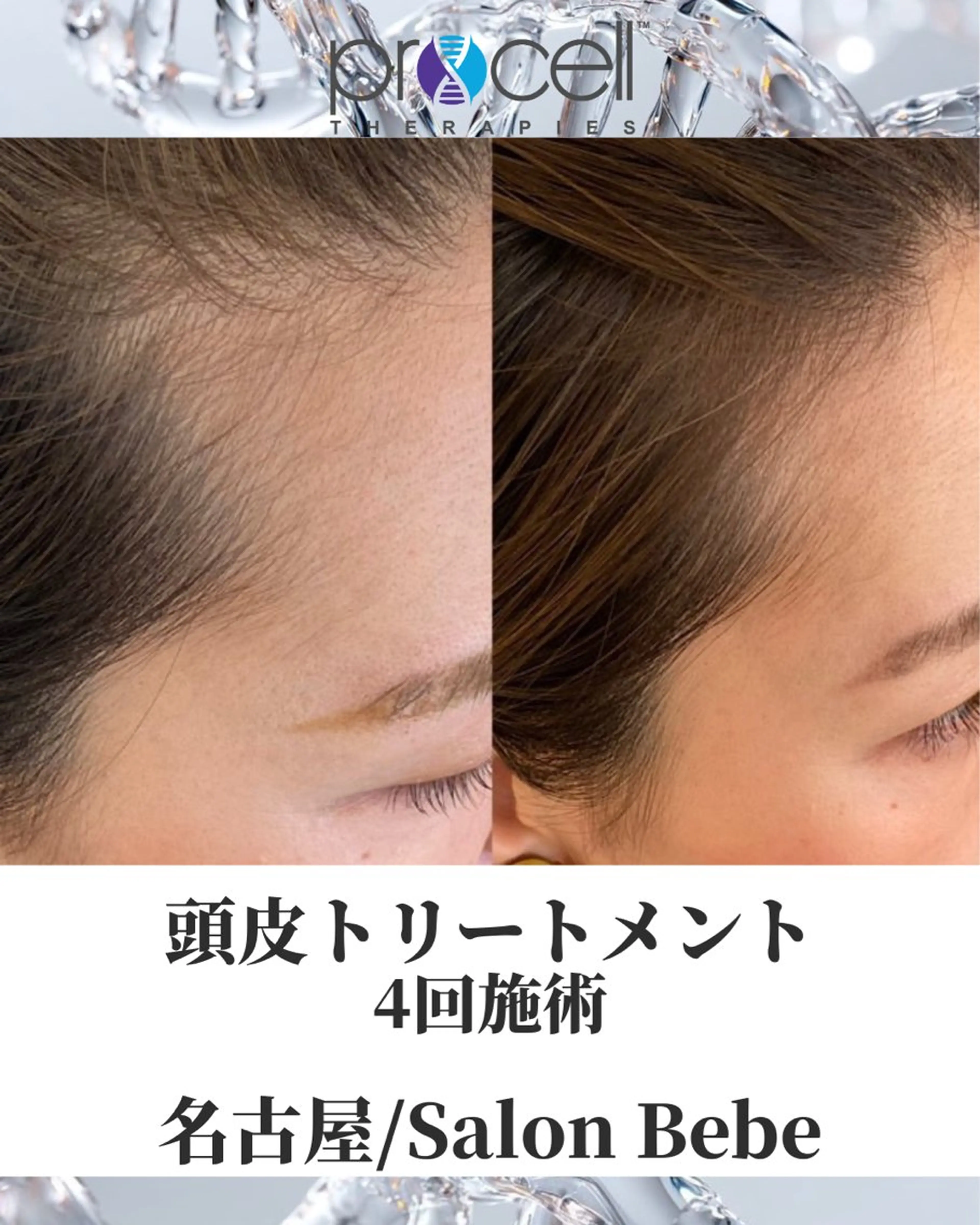 🇺🇸皮膚科医開発｜医療や高額ケアでも満足できなかった方へ。最新美容液をスピード導入で理想の髪への写真