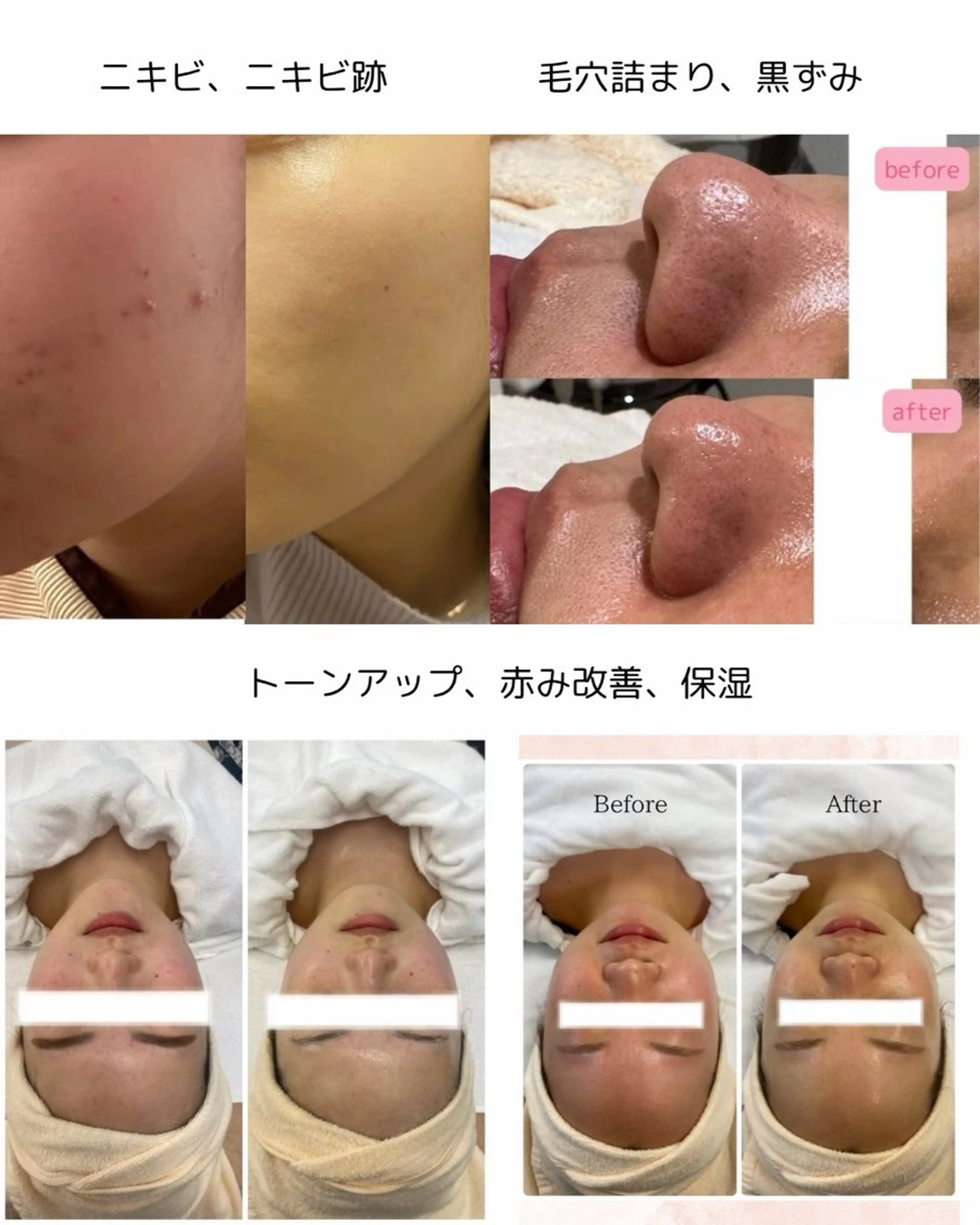フェイシャルエステ ゆうかのエステ・リラクイメージ
