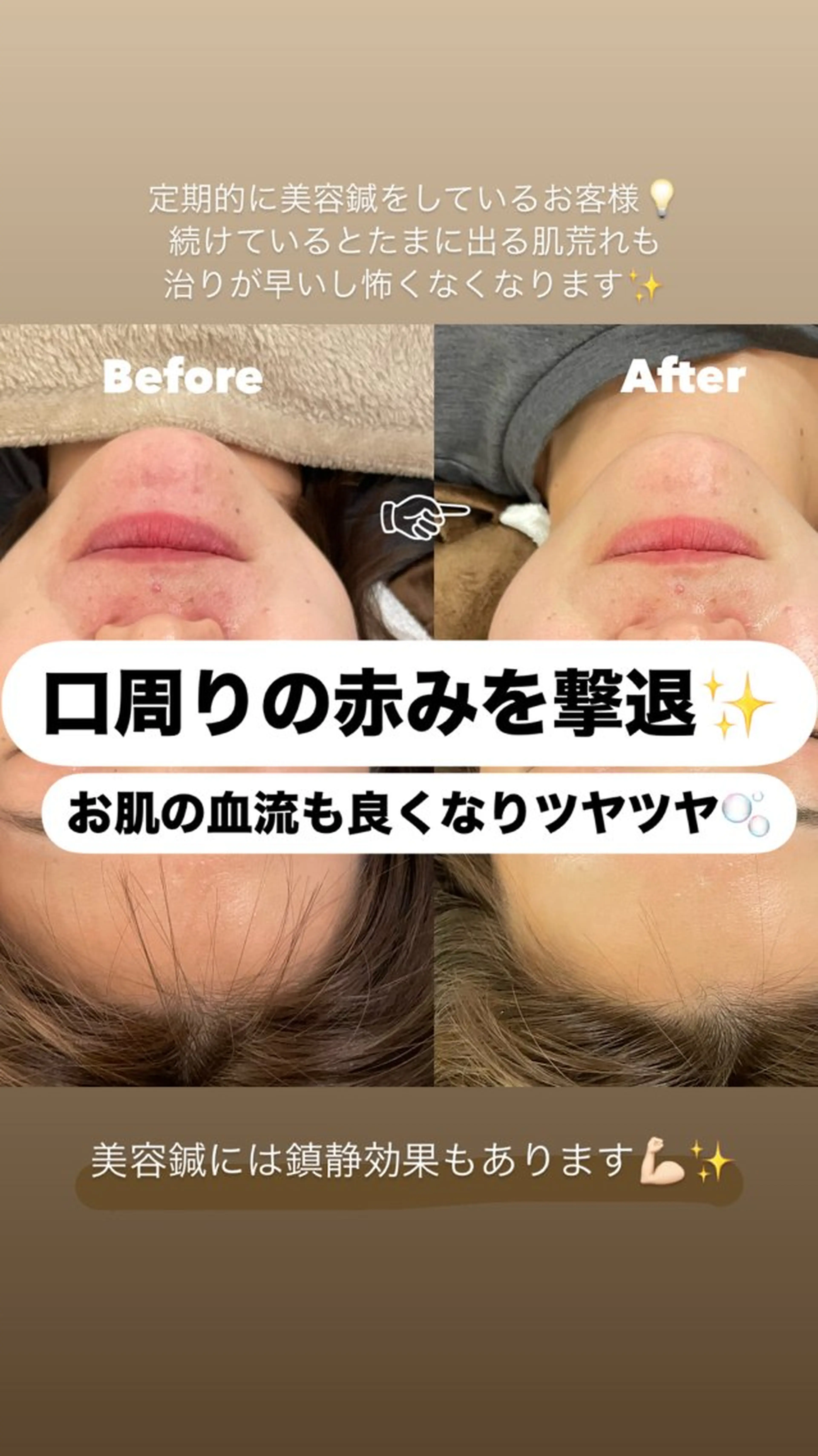 美容鍼/鍼灸 ここみ鍼灸院のエステ・リラクイメージ