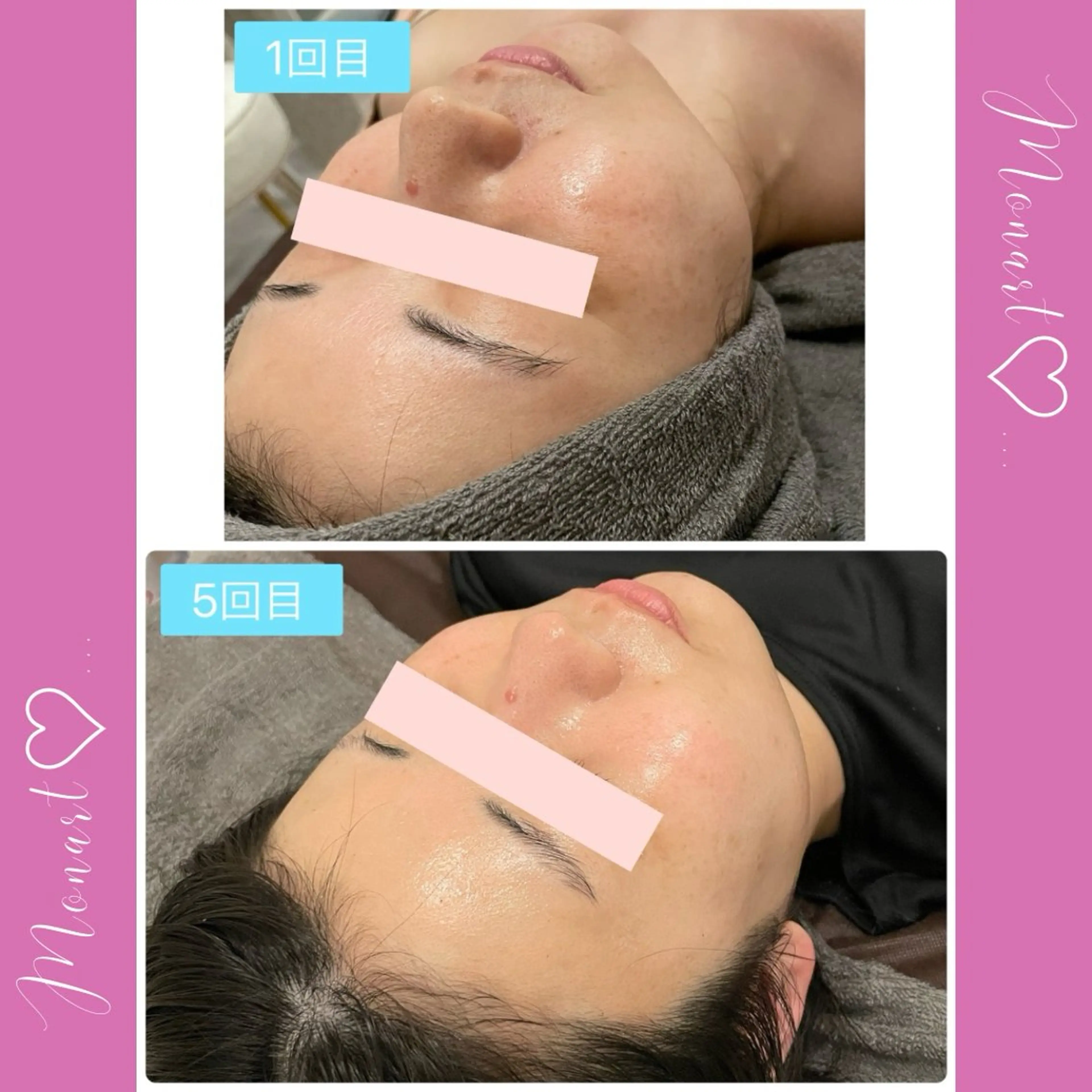 Monart -deux-のエステ・リラクイメージ