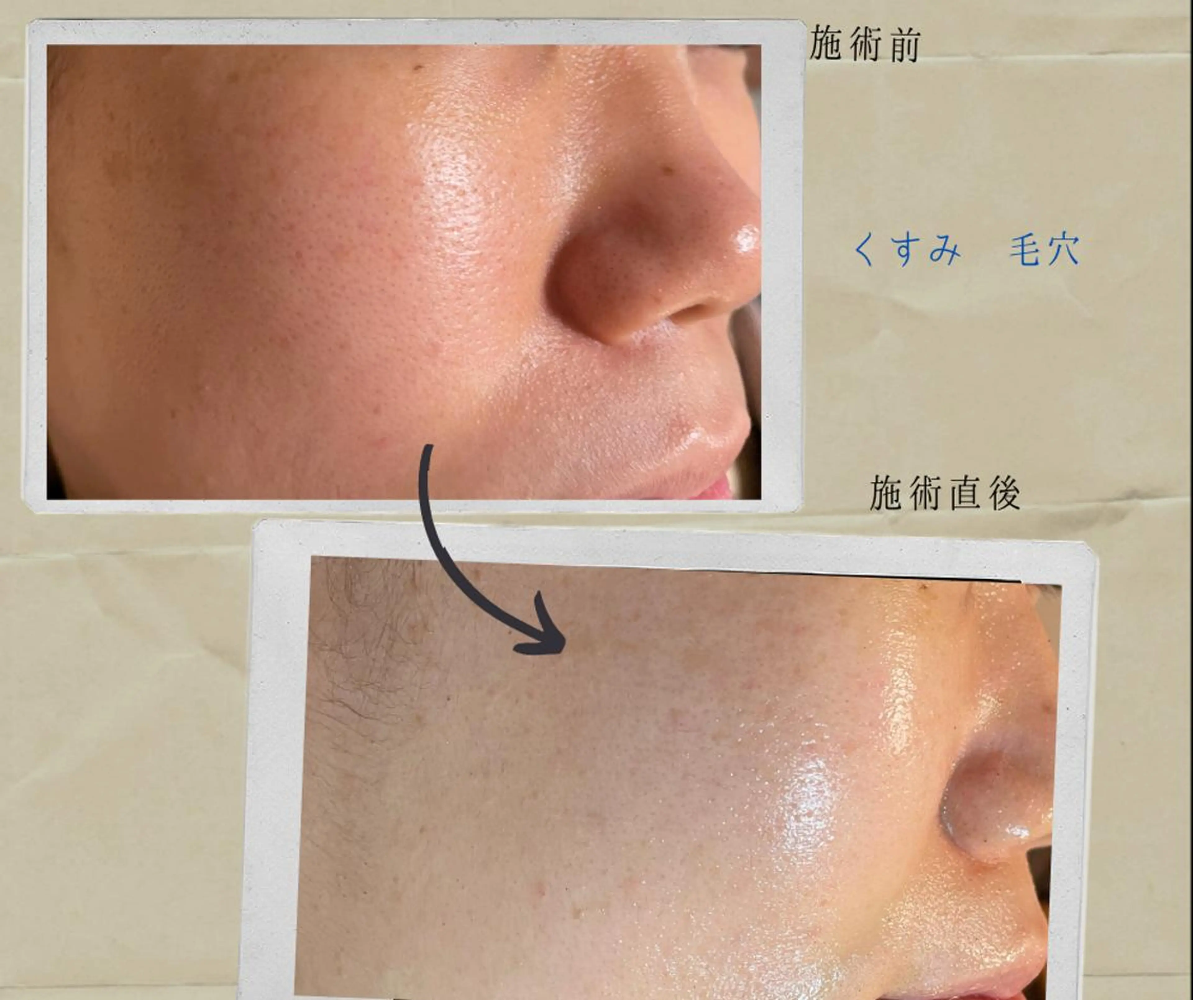 代表 MOMOのエステ・リラクイメージ