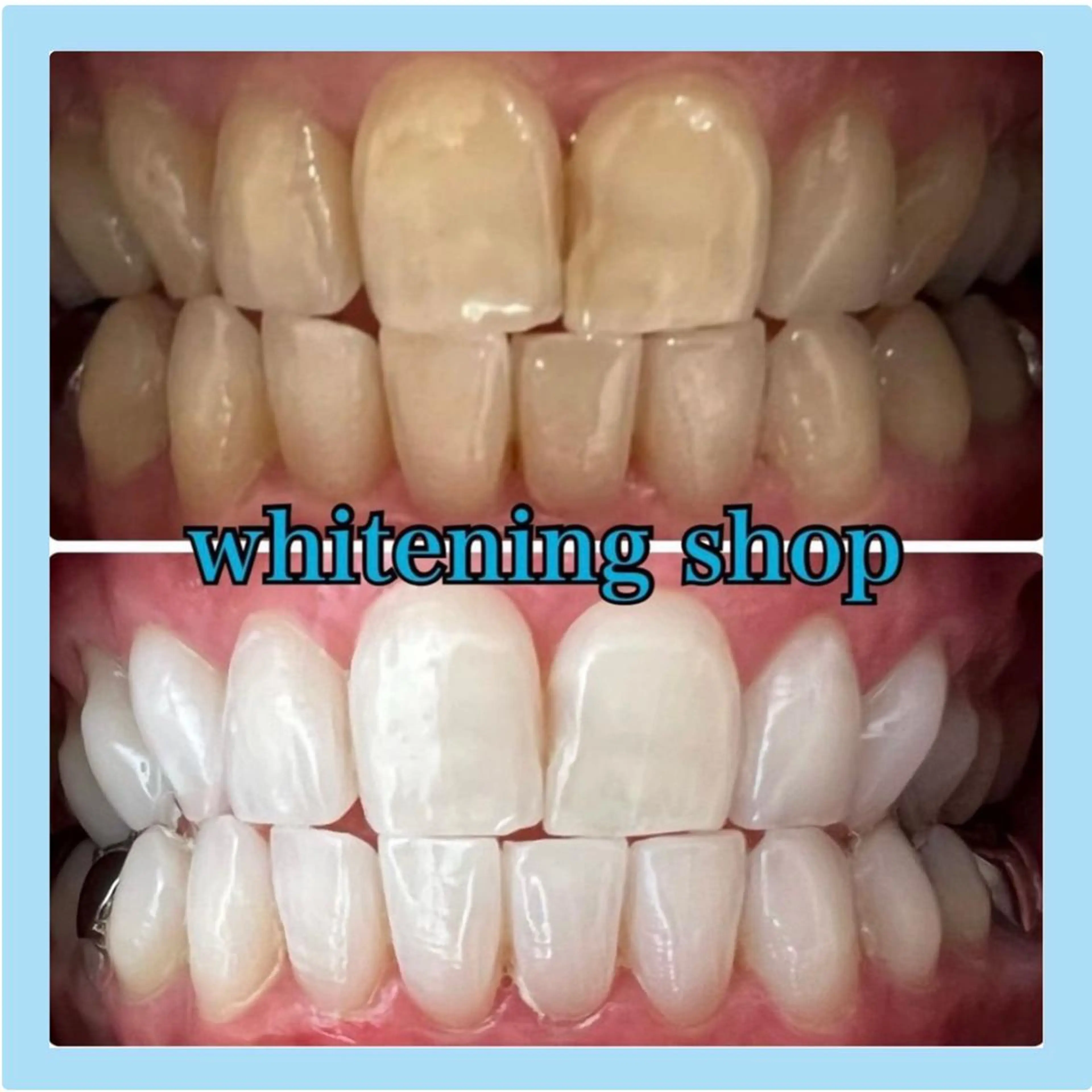 ホワイトニング ショップ千葉店のその他イメージ