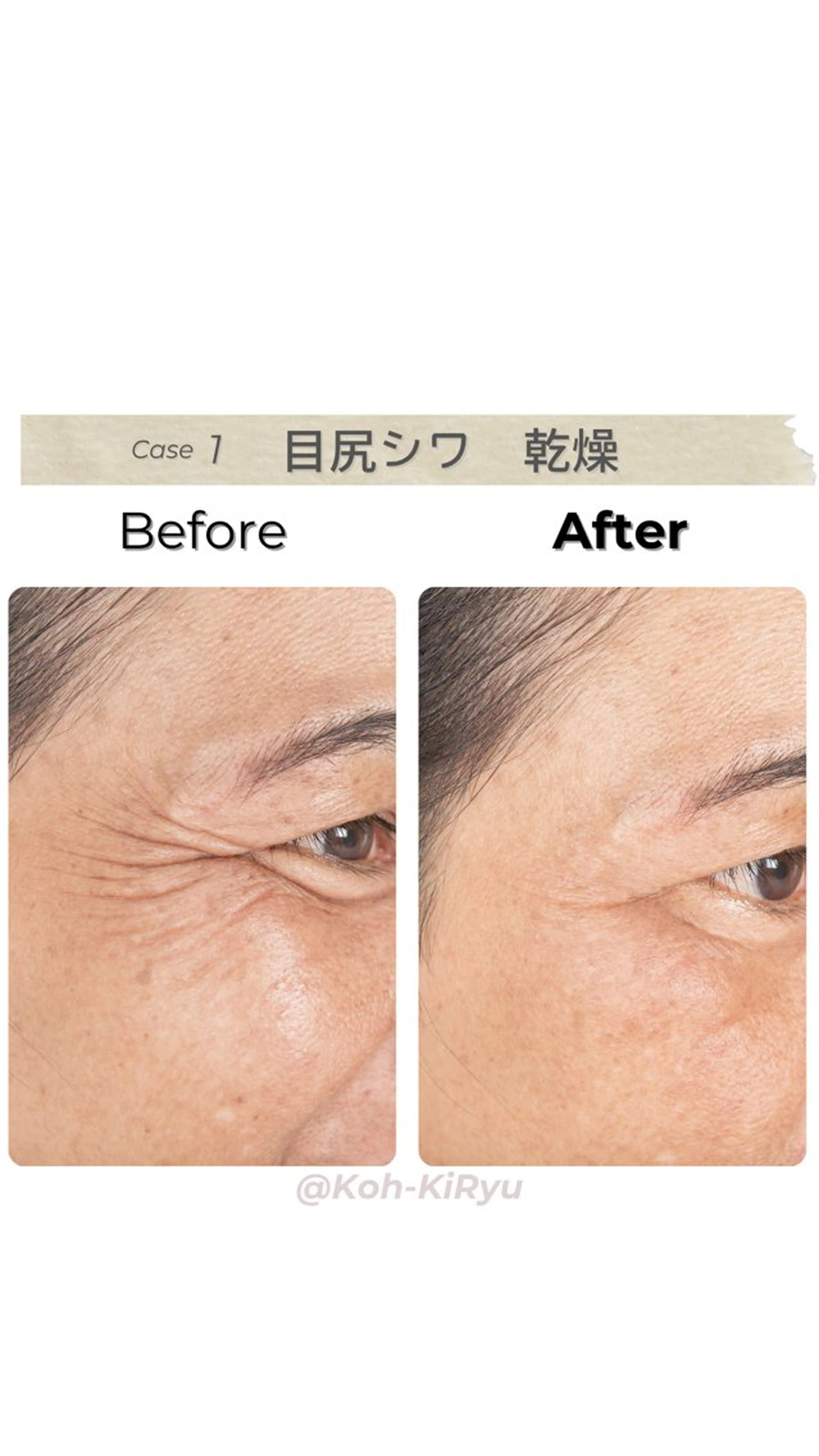 その他 体質改善✨美肌育サロ ン　香嬉琉🌿きよかのエステ・リラクイメージ