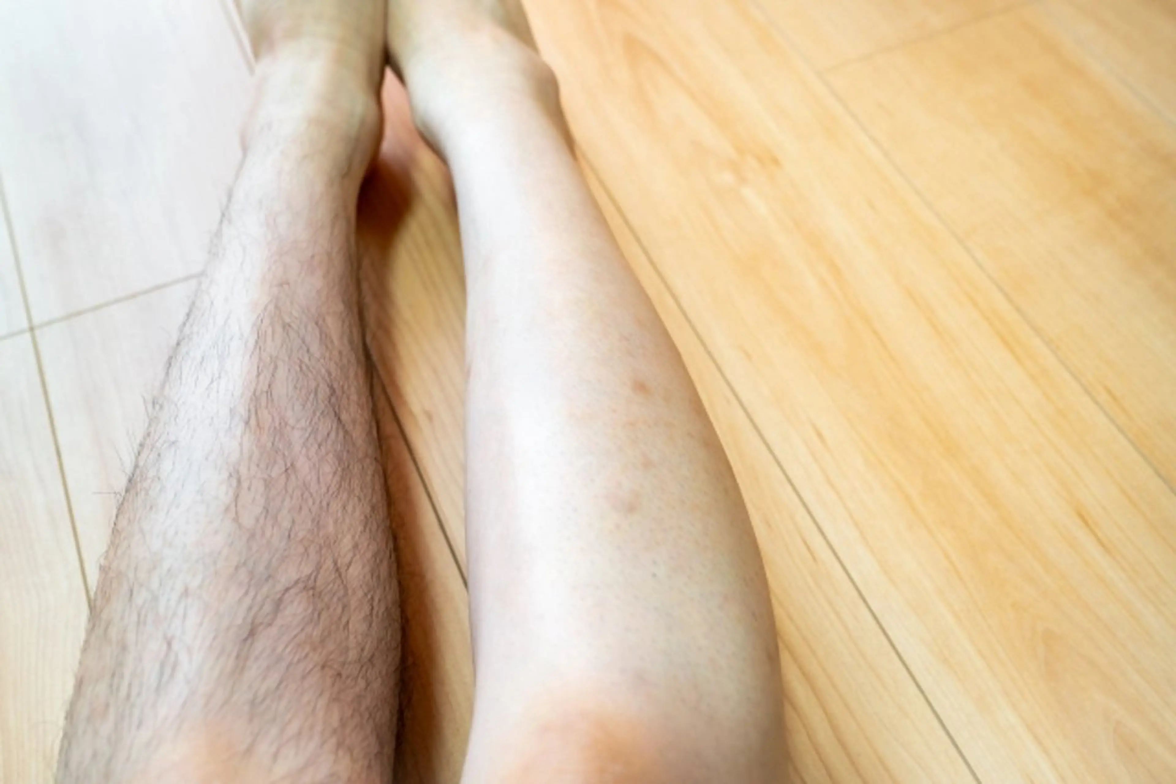 脱毛 美容鍼・脱毛サロン CURAIMのエステ・リラクイメージ