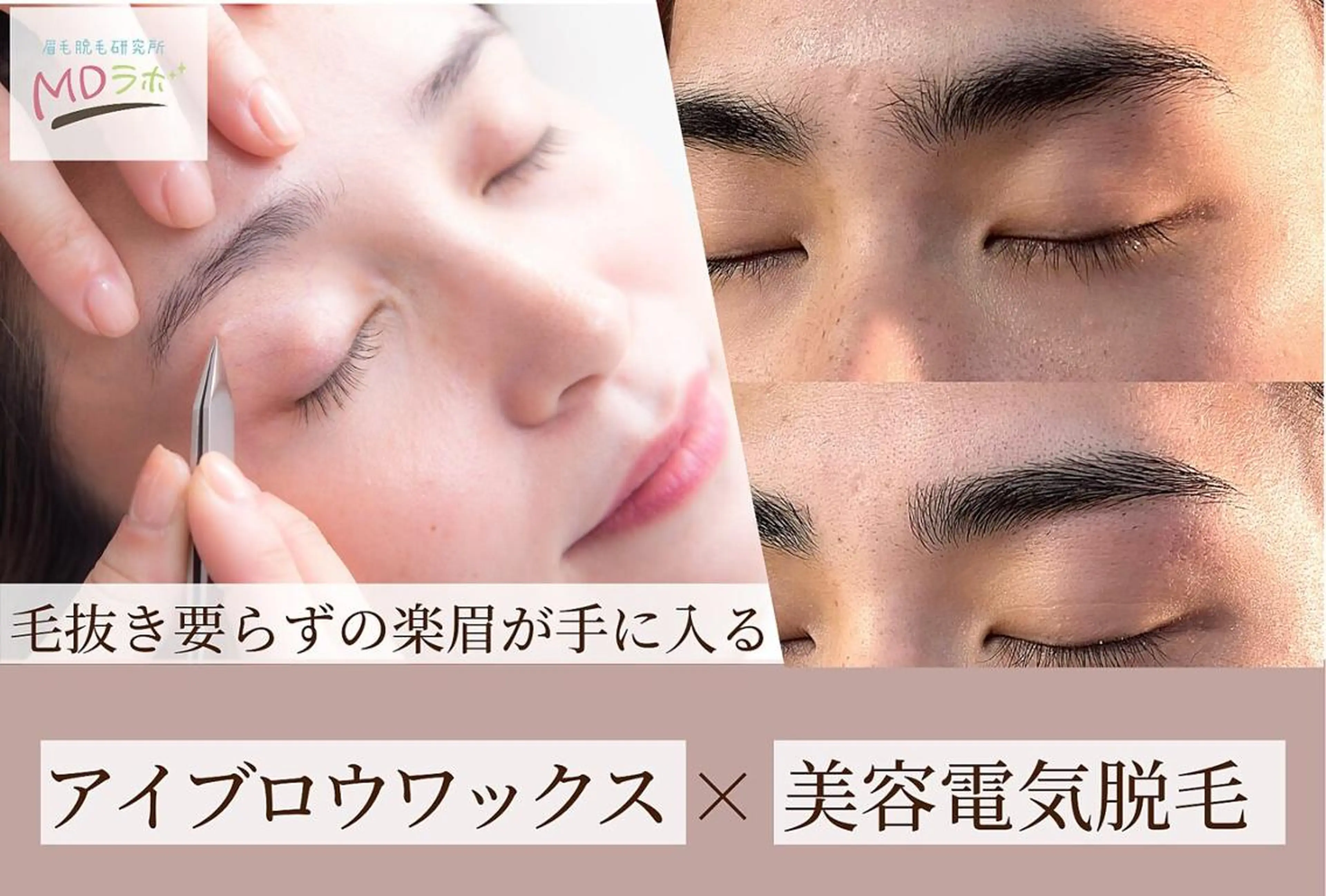 【人気NO1】自己処理要らずの楽眉作成★眉WAX＋美容電気脱毛11,500円→7,800円の写真