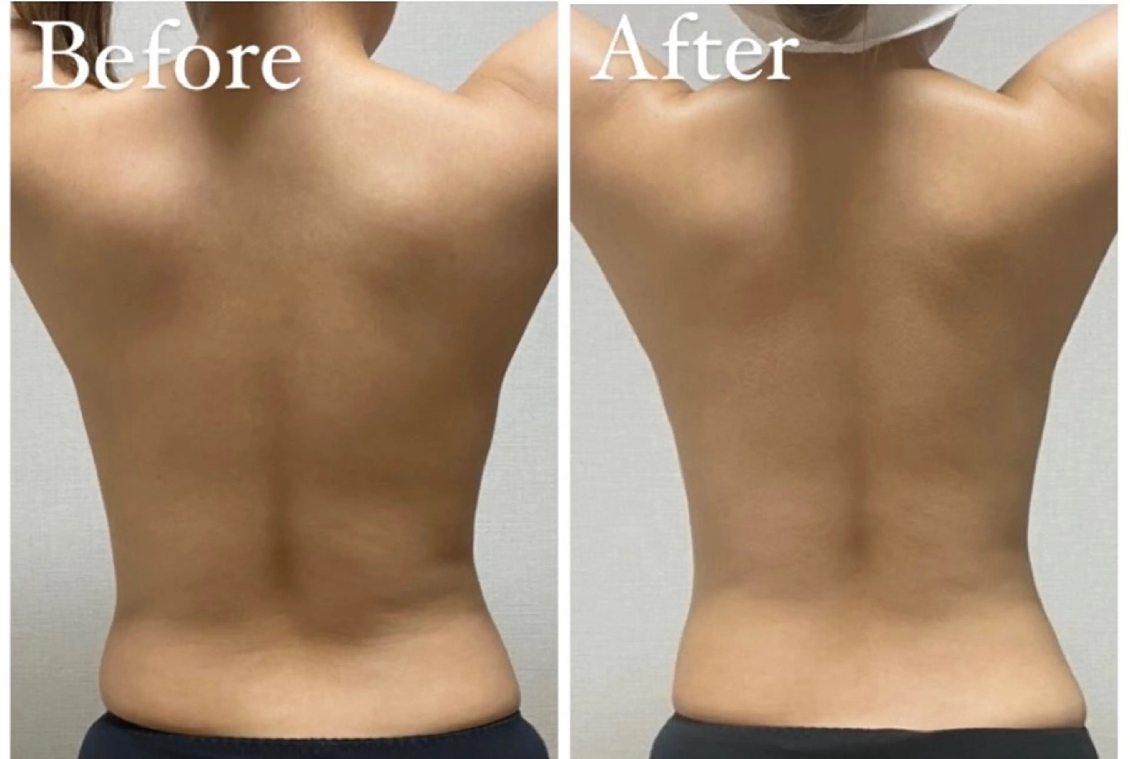 beautysalon RAVIS所属・東大阪/韓国肌管理/ 痩身バスト専門店のエステ・リラクイメージ